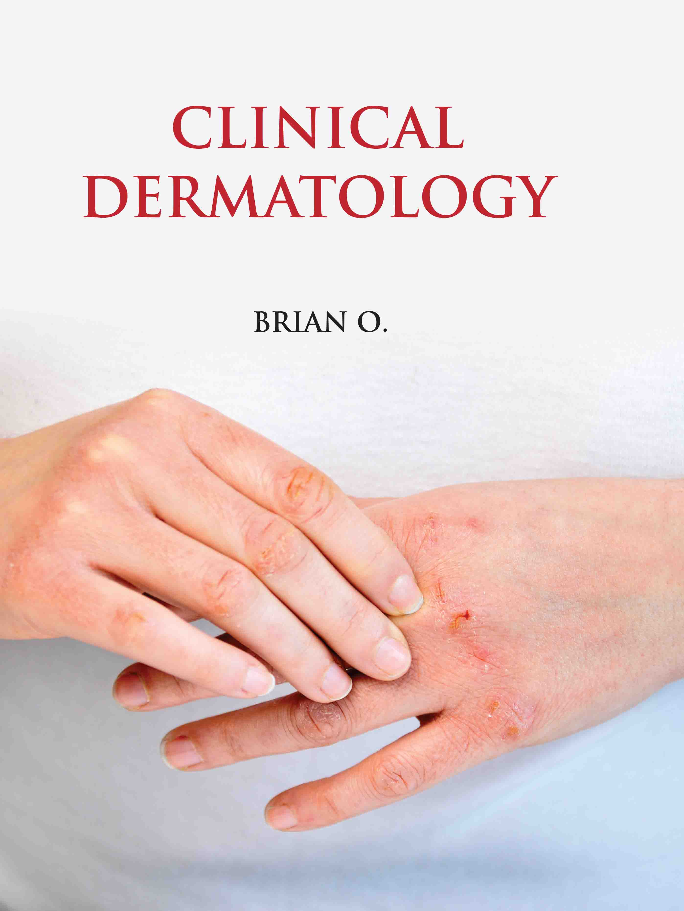 Clinical Dermatology