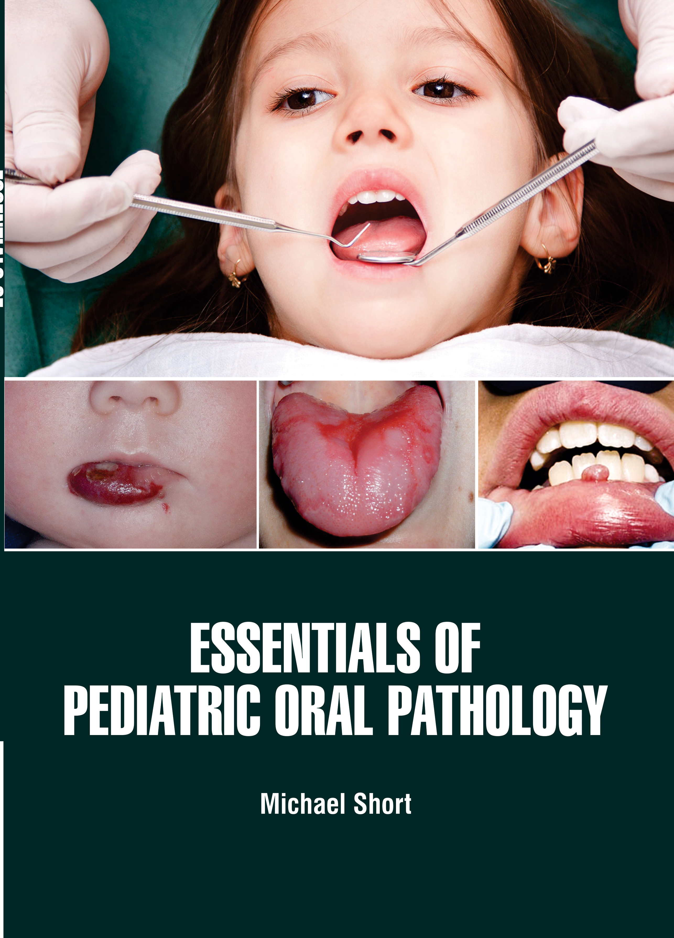 Essentials of Pediatric Oral Pathology