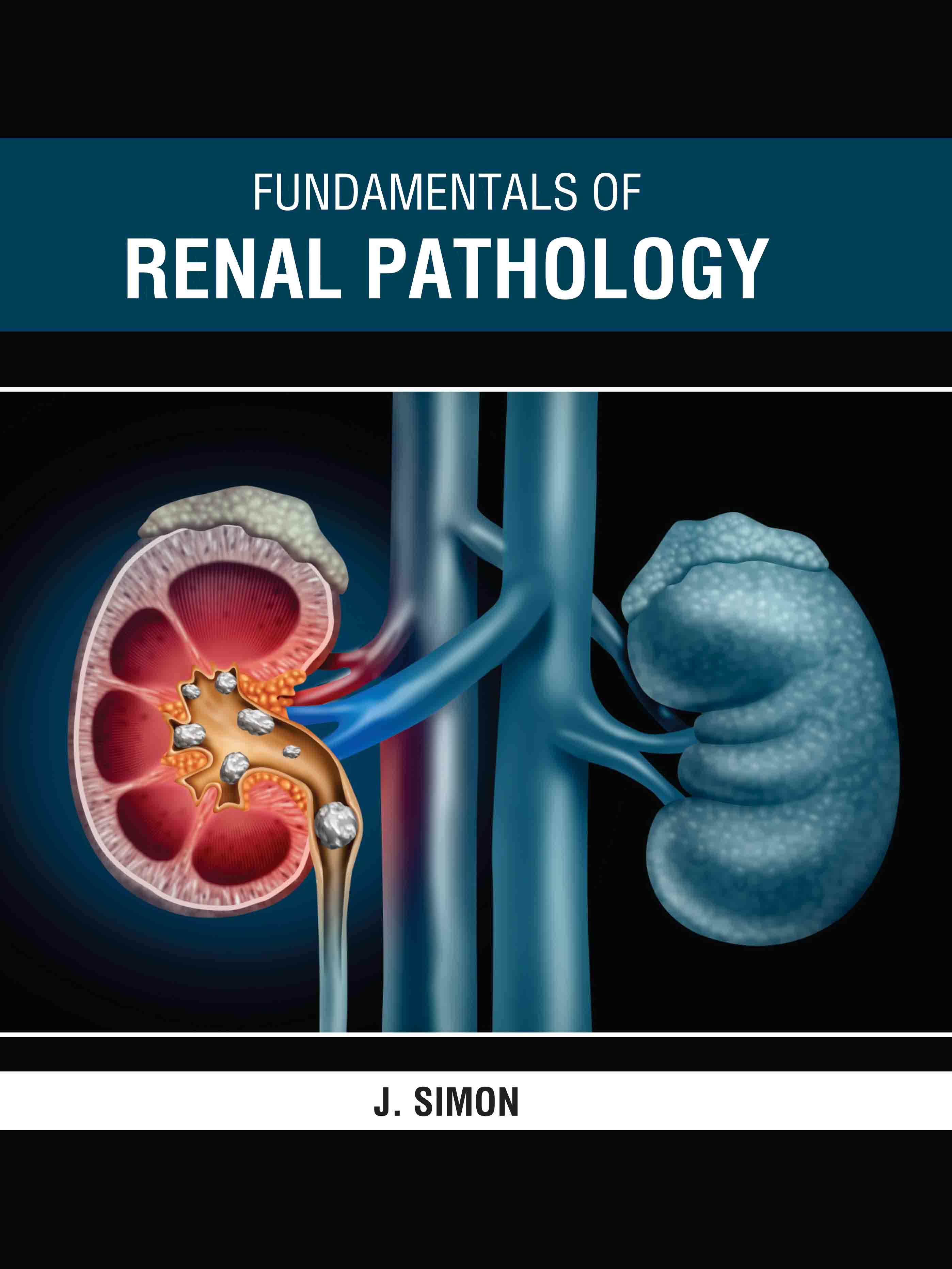 Fundamentals of Renal Pathology