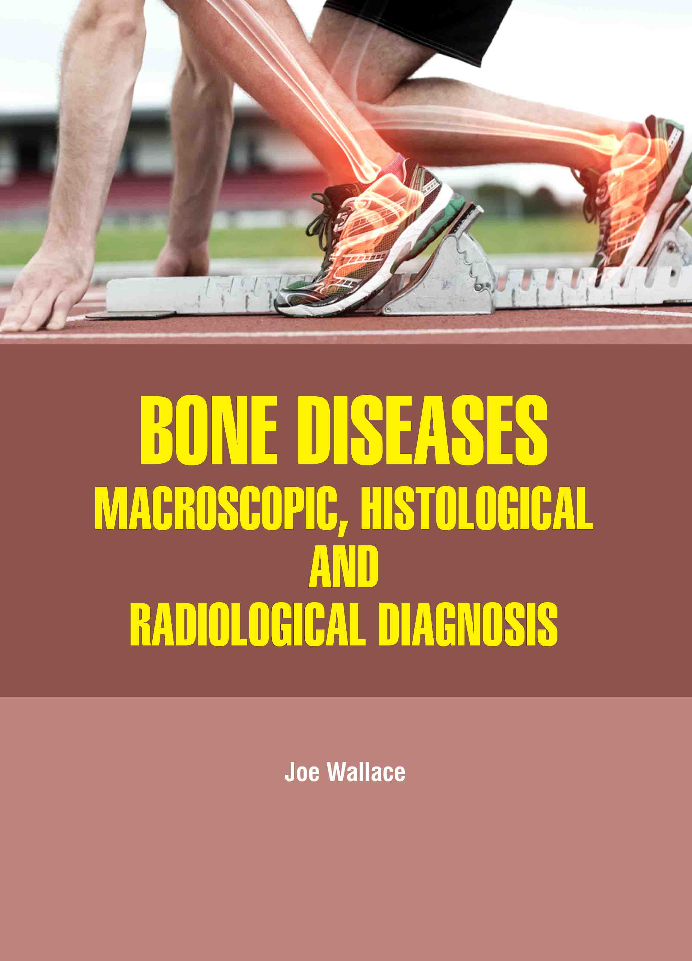 Bone Diseases: Macroscopic, Histological and Radiological Diagnosis