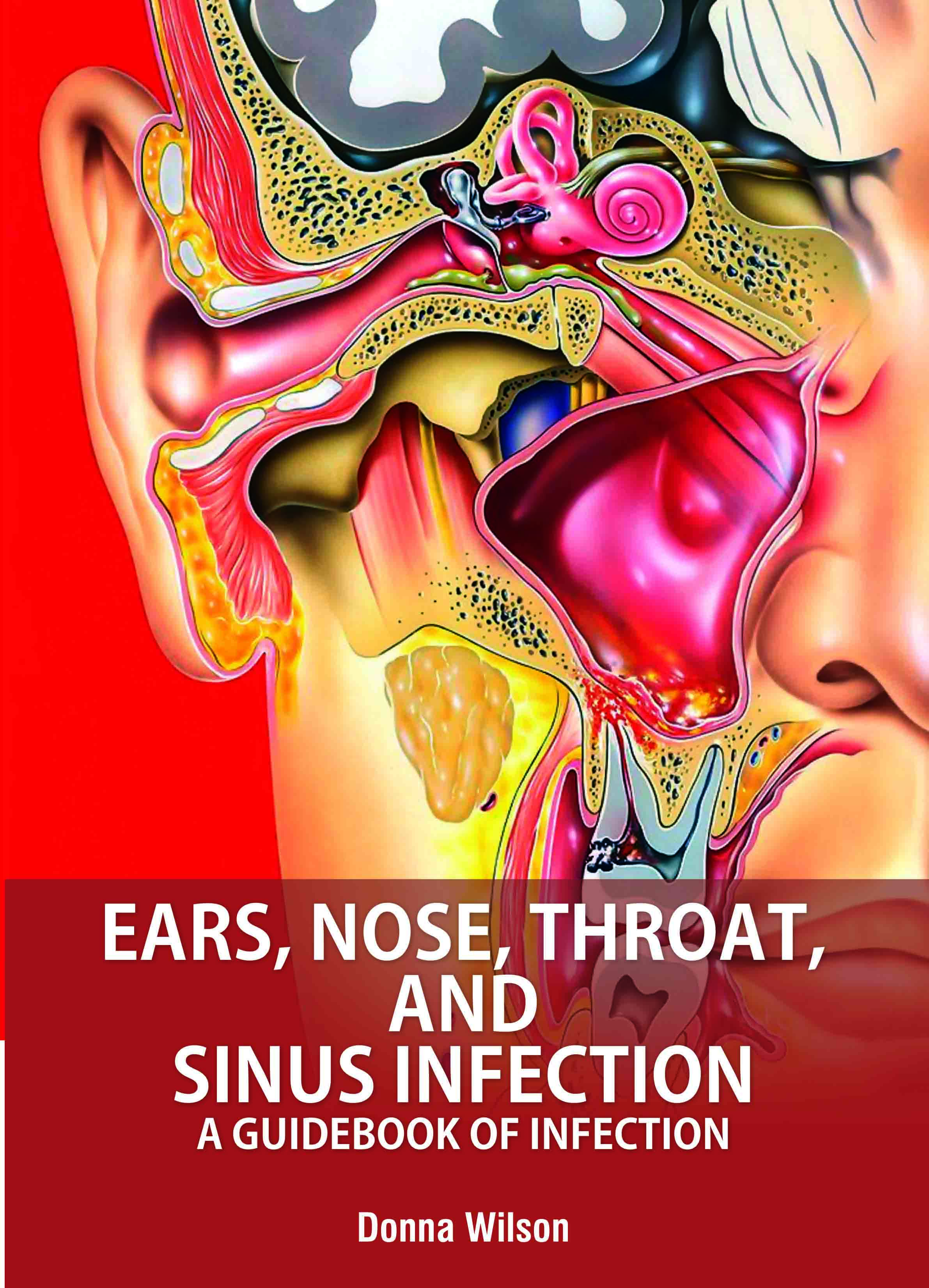 Ears, Nose, Throat, and Sinus Infection: A Guidebook of Infection