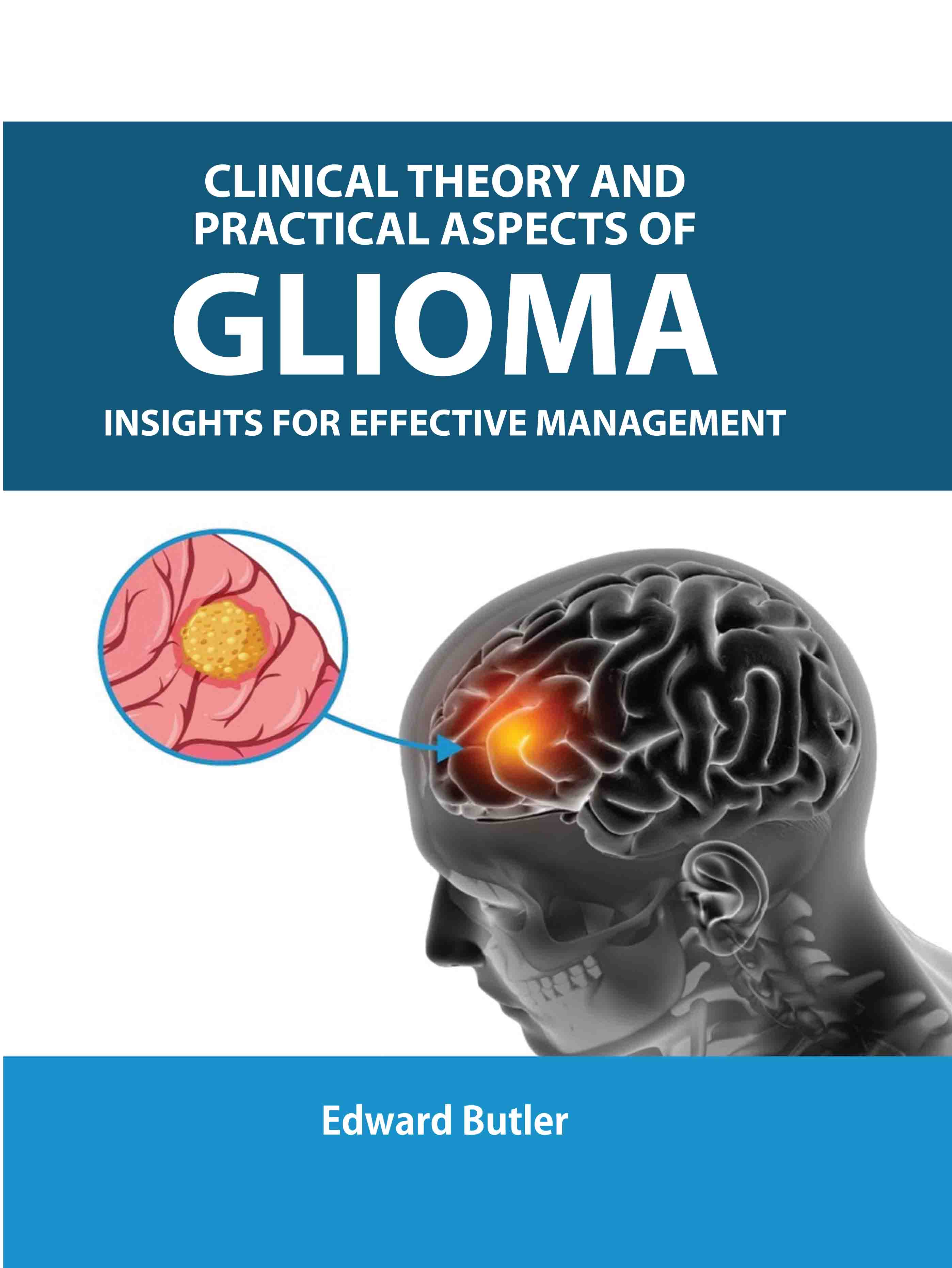Clinical Theory and Practical Aspects of Glioma: Insights for Effective Management