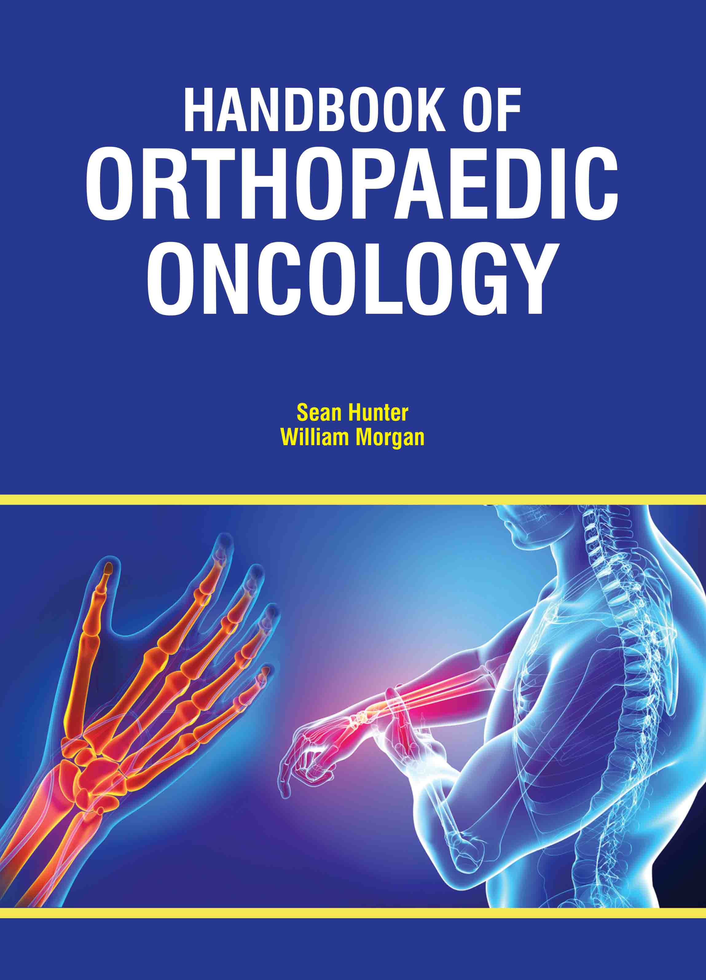 Handbook of Orthopedic Oncology