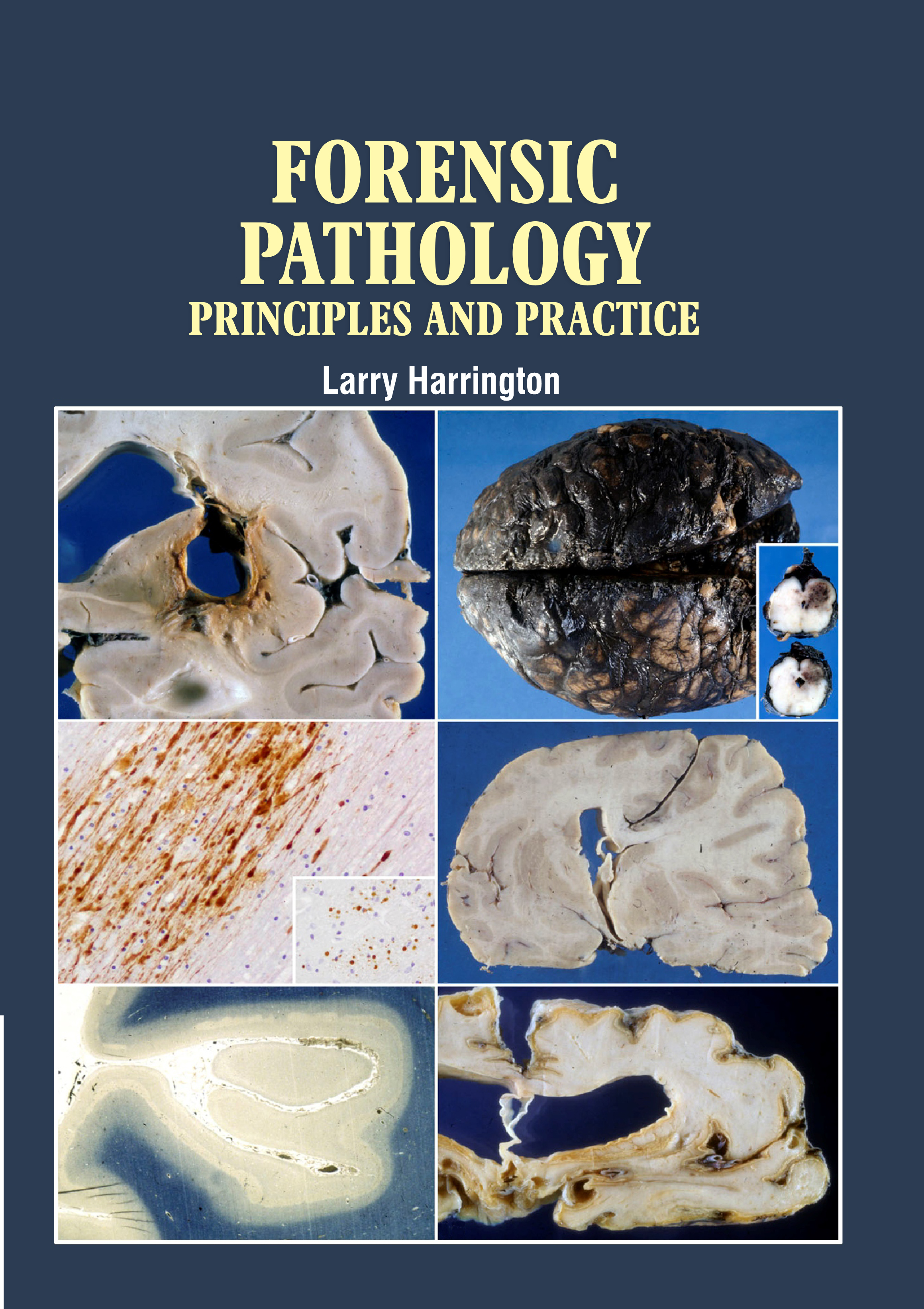 Forensic Pathology: Principles and Practice