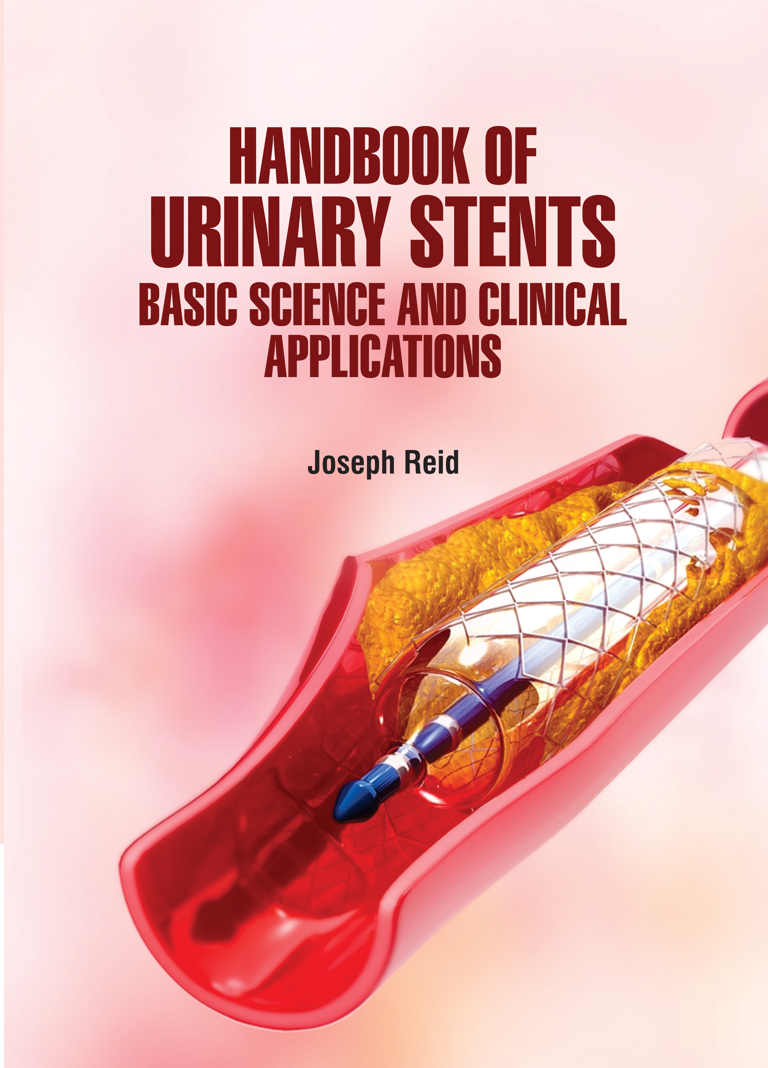 Handbook of Urinary Stents: Basic Science and Clinical Applications