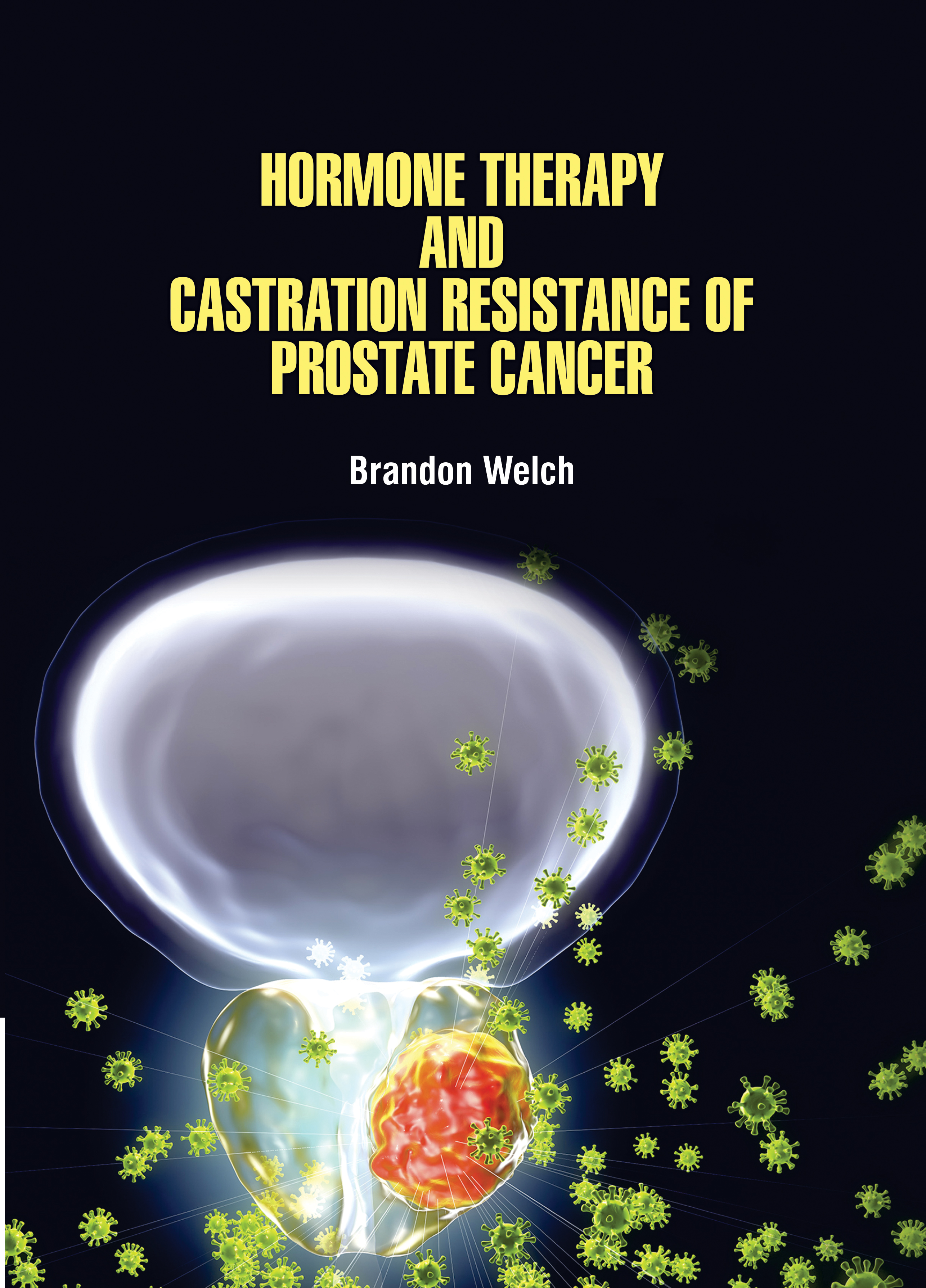 Hormone Therapy and Castration Resistance of Prostate Cancer