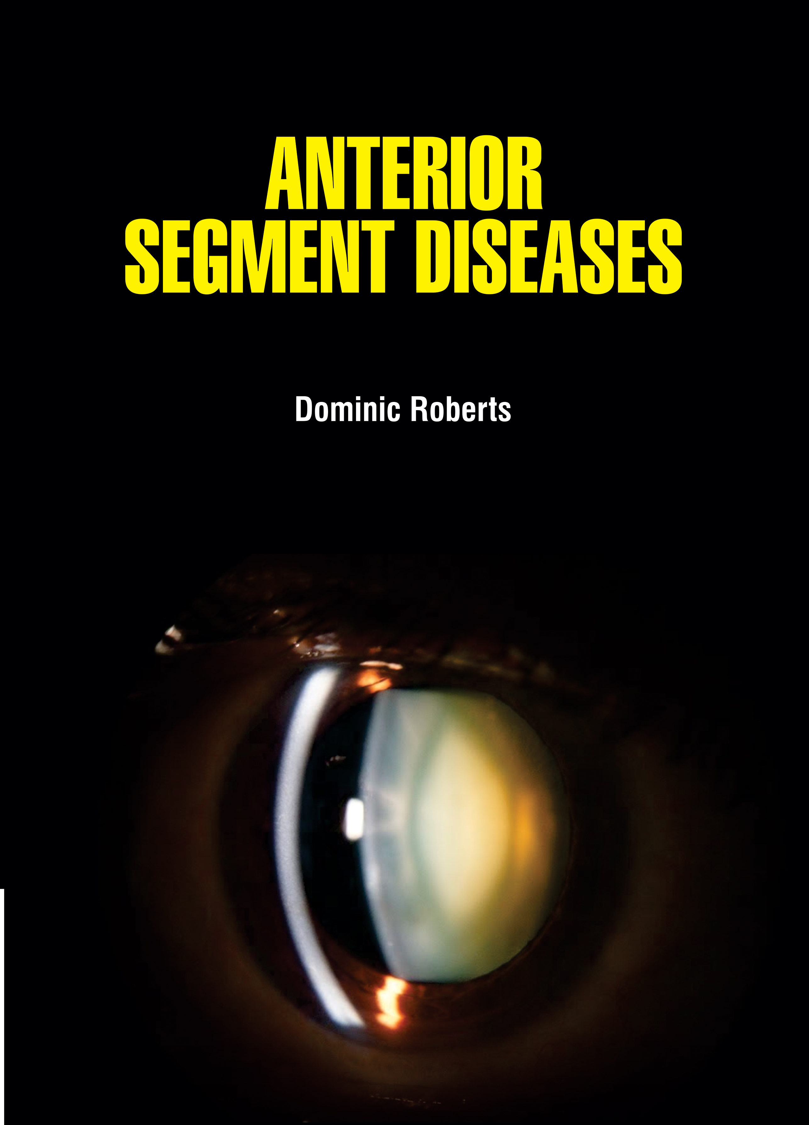 Anterior Segment Diseases