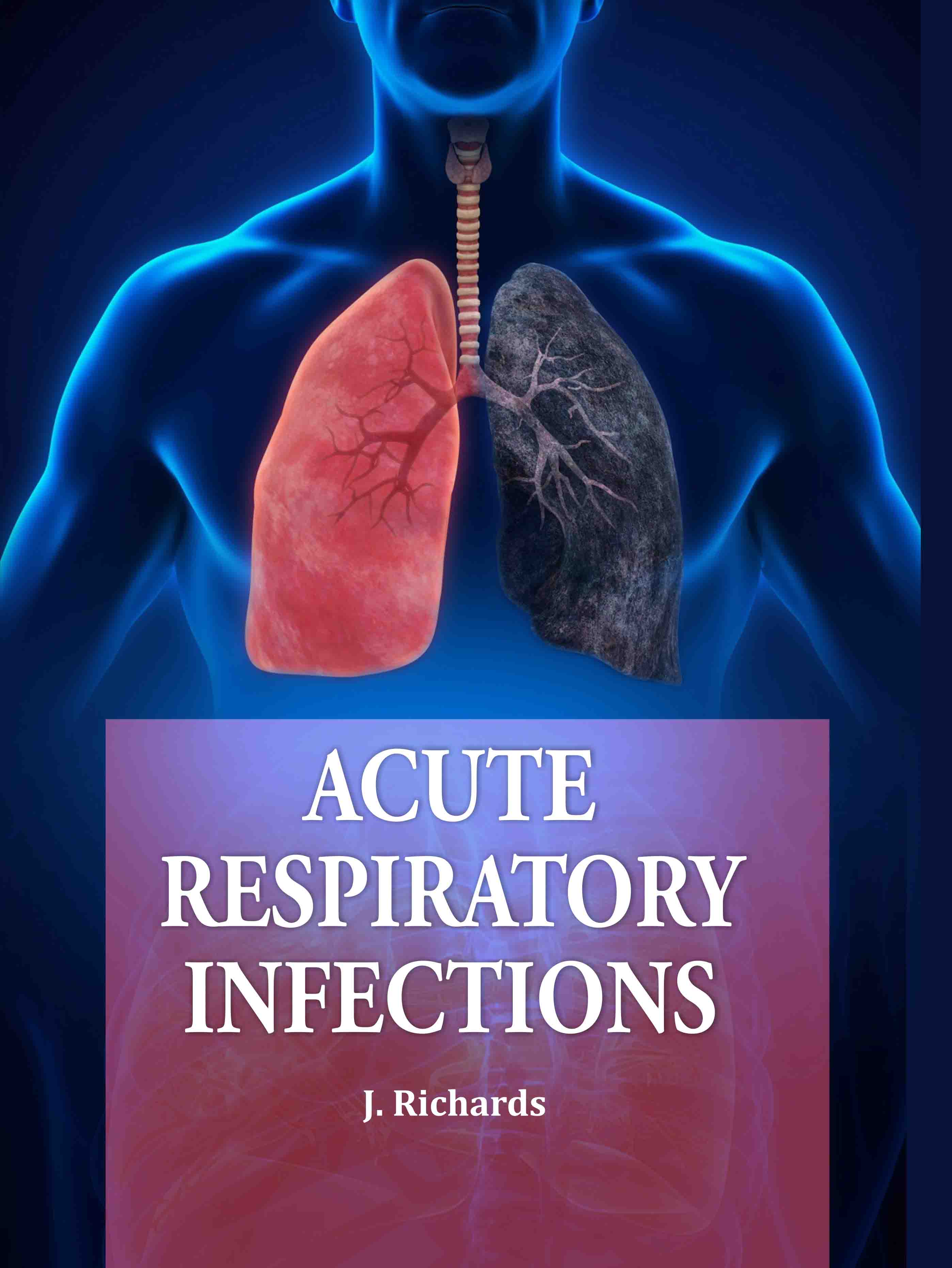 Acute Respiratory Infections