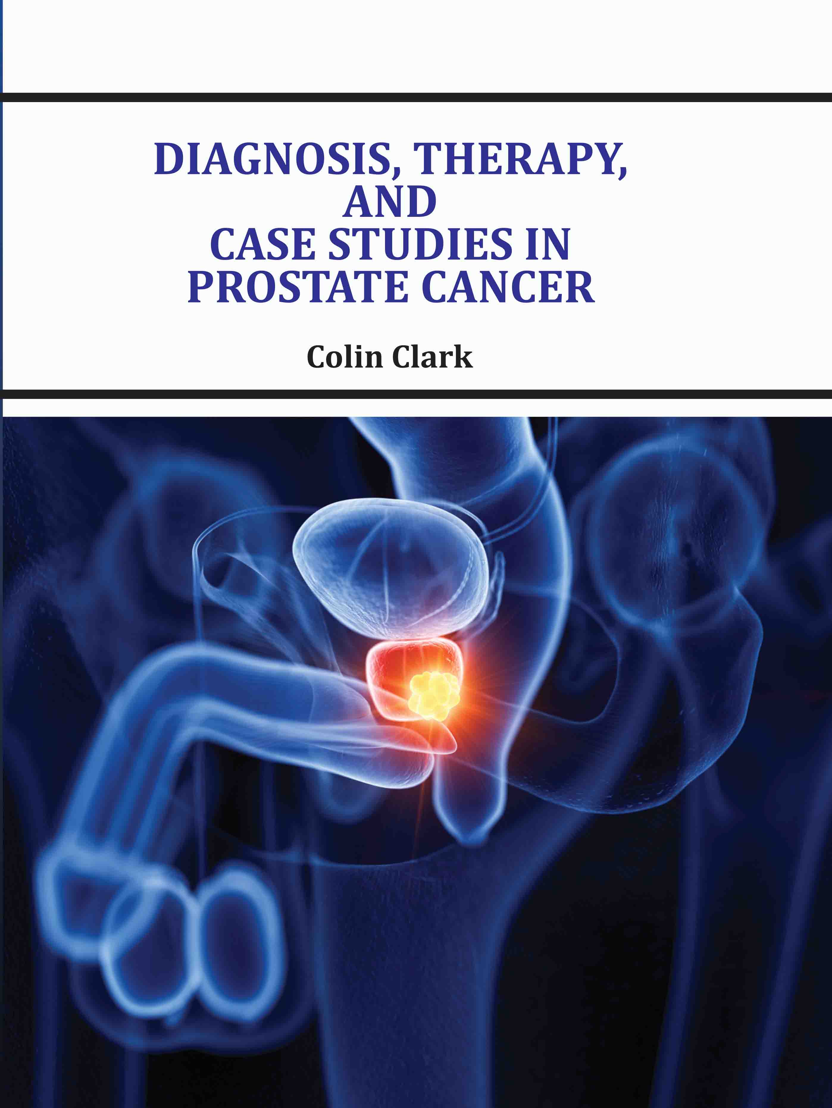 Diagnosis, Therapy, and Case Studies in Prostate Cancer