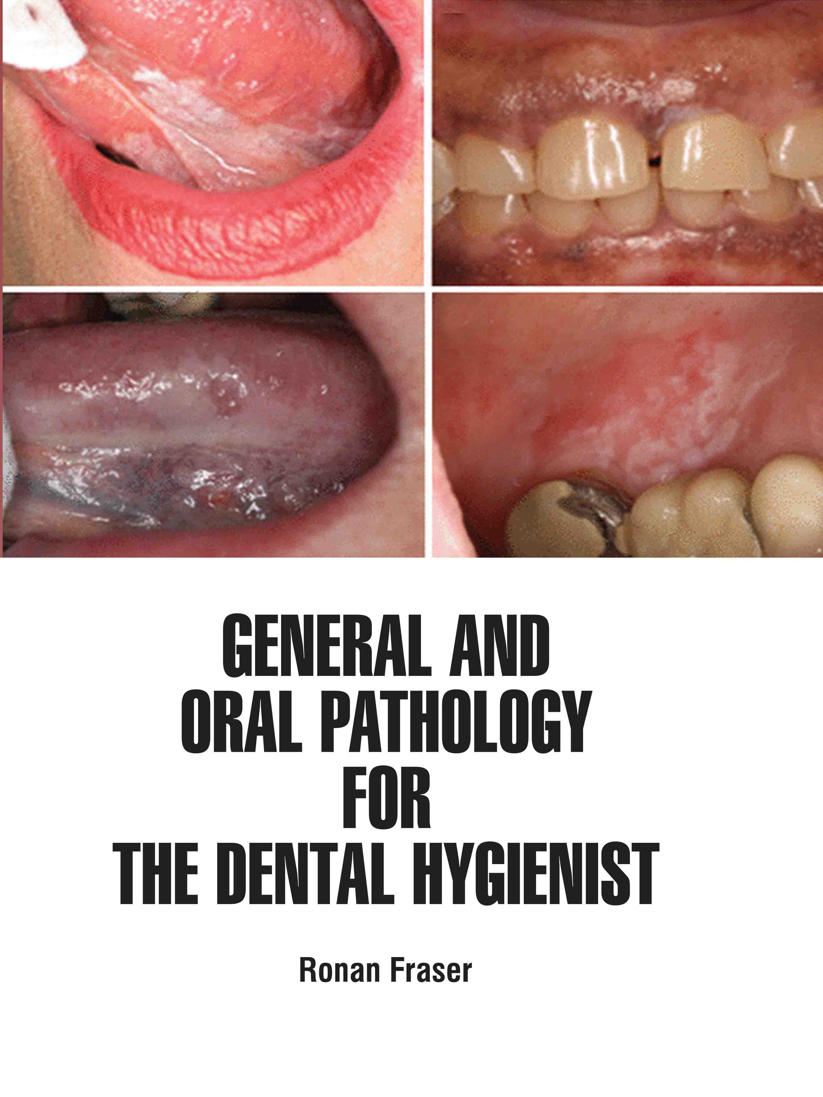 General and Oral Pathology for The Dental Hygienist