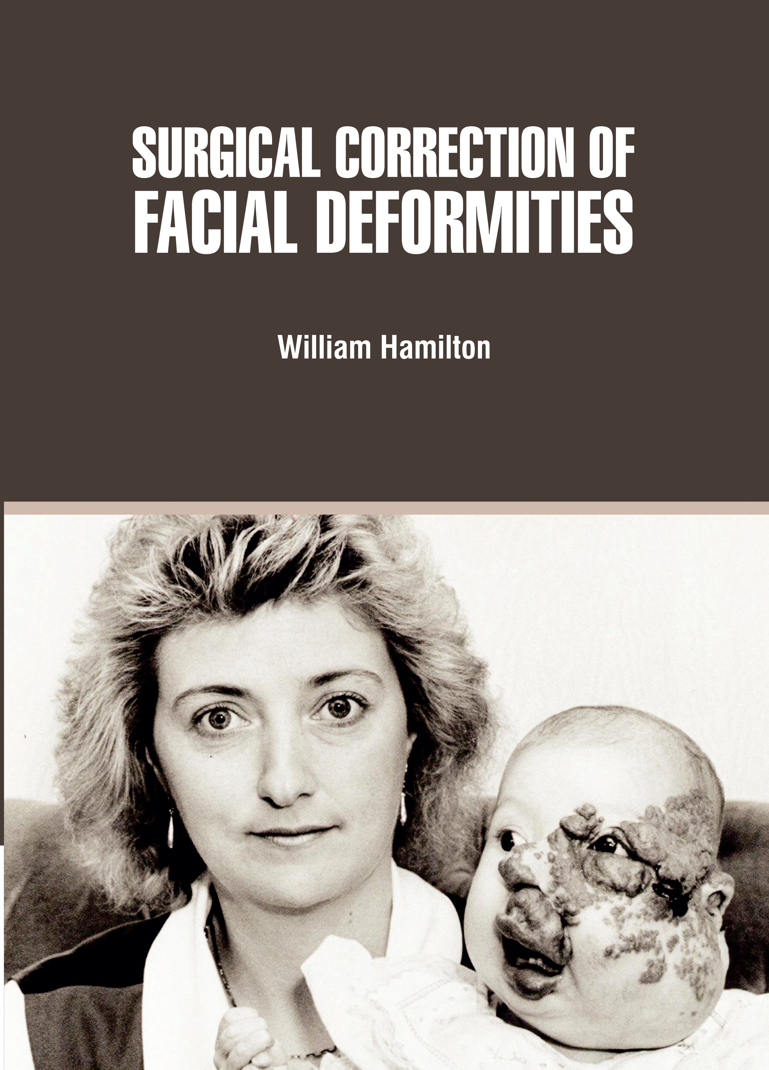 Surgical Correction of Facial Deformities