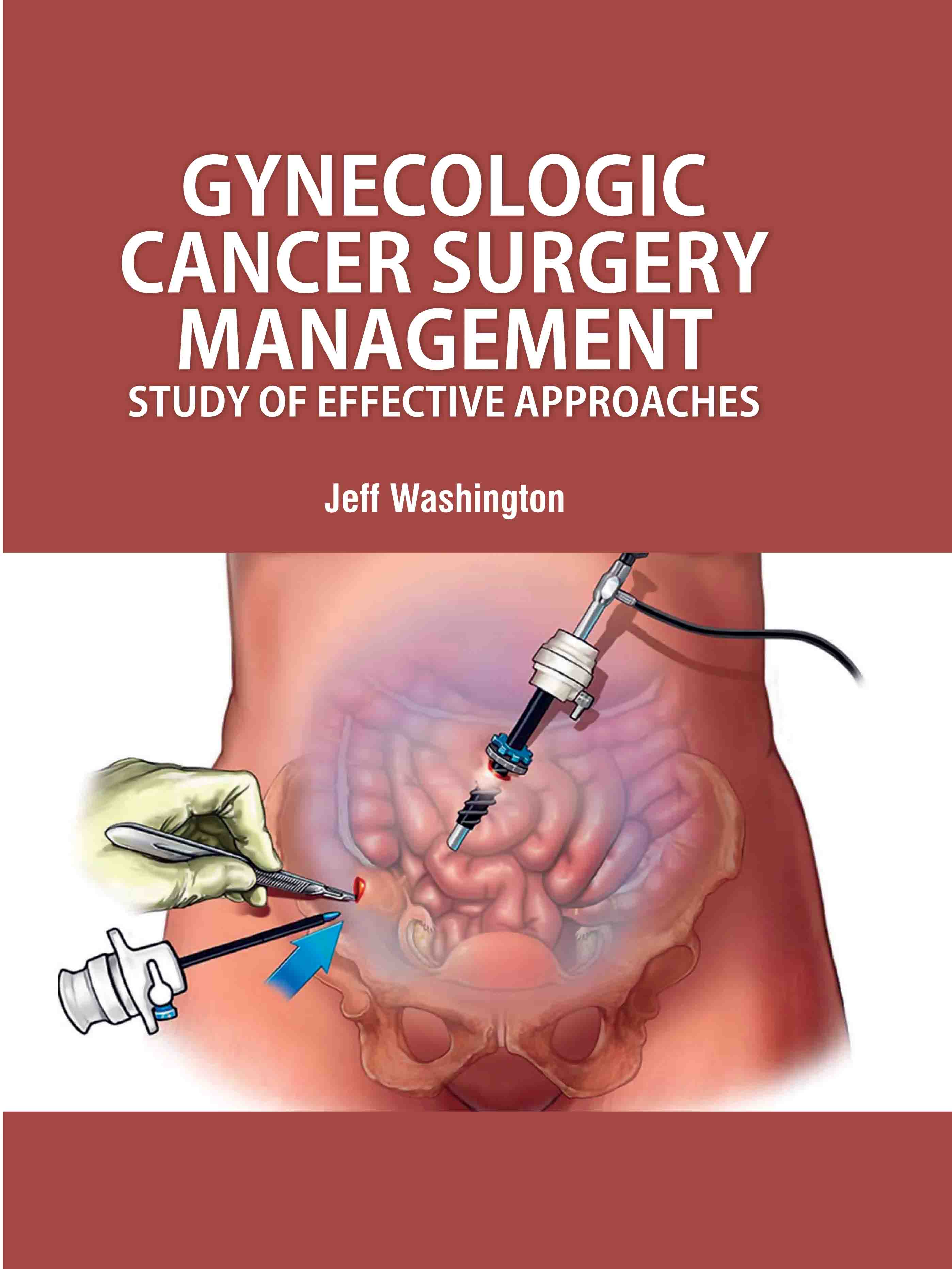 Gynecologic Cancer Surgery Management: Study of Effective Approaches