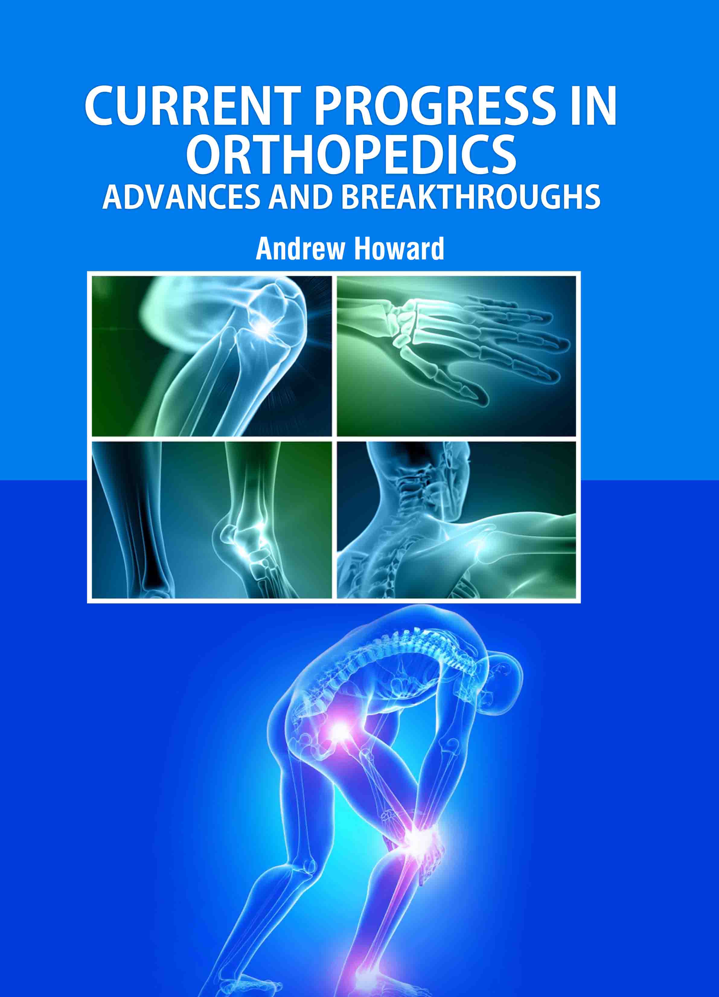 Current Progress in Orthopedics: Advances and Breakthroughs