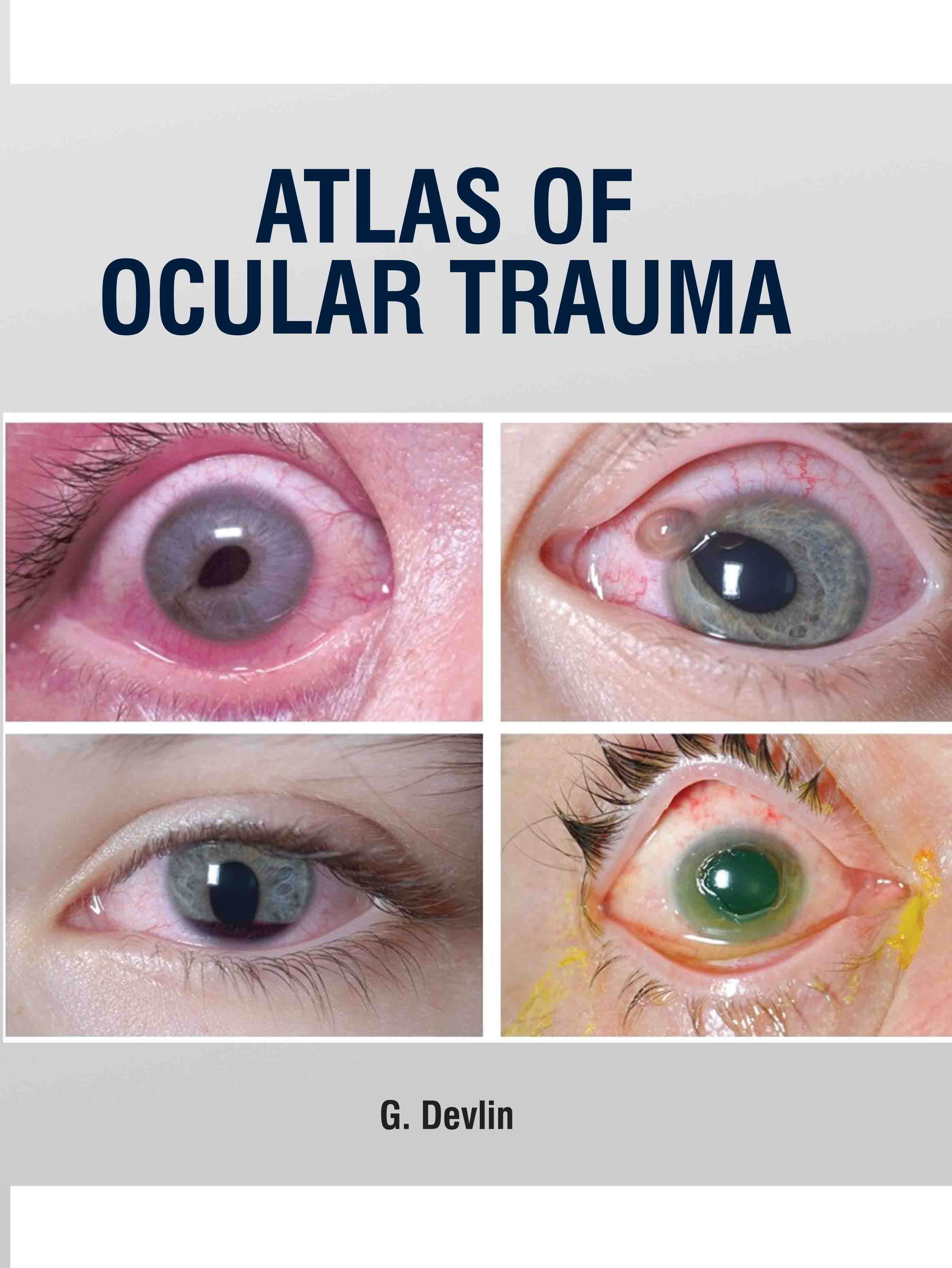 Atlas of Ocular Trauma