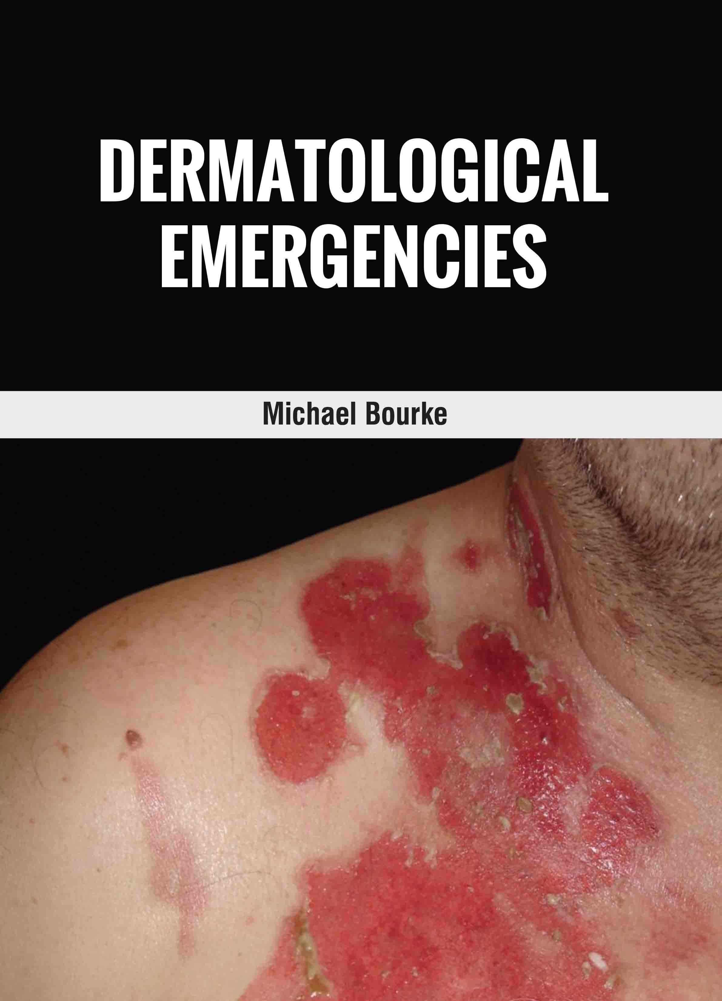 Dermatological Emergencies