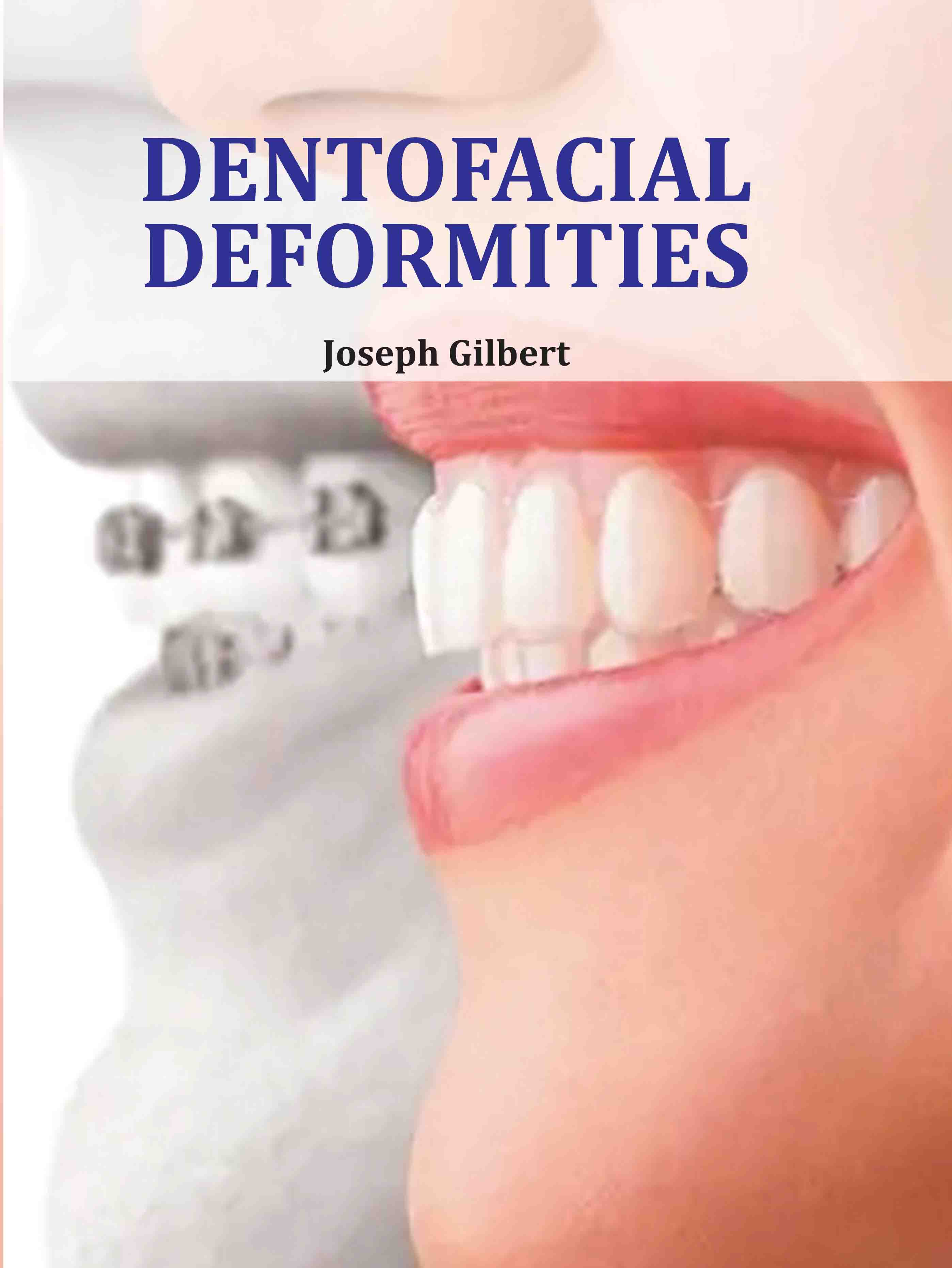 Dentofacial Deformities