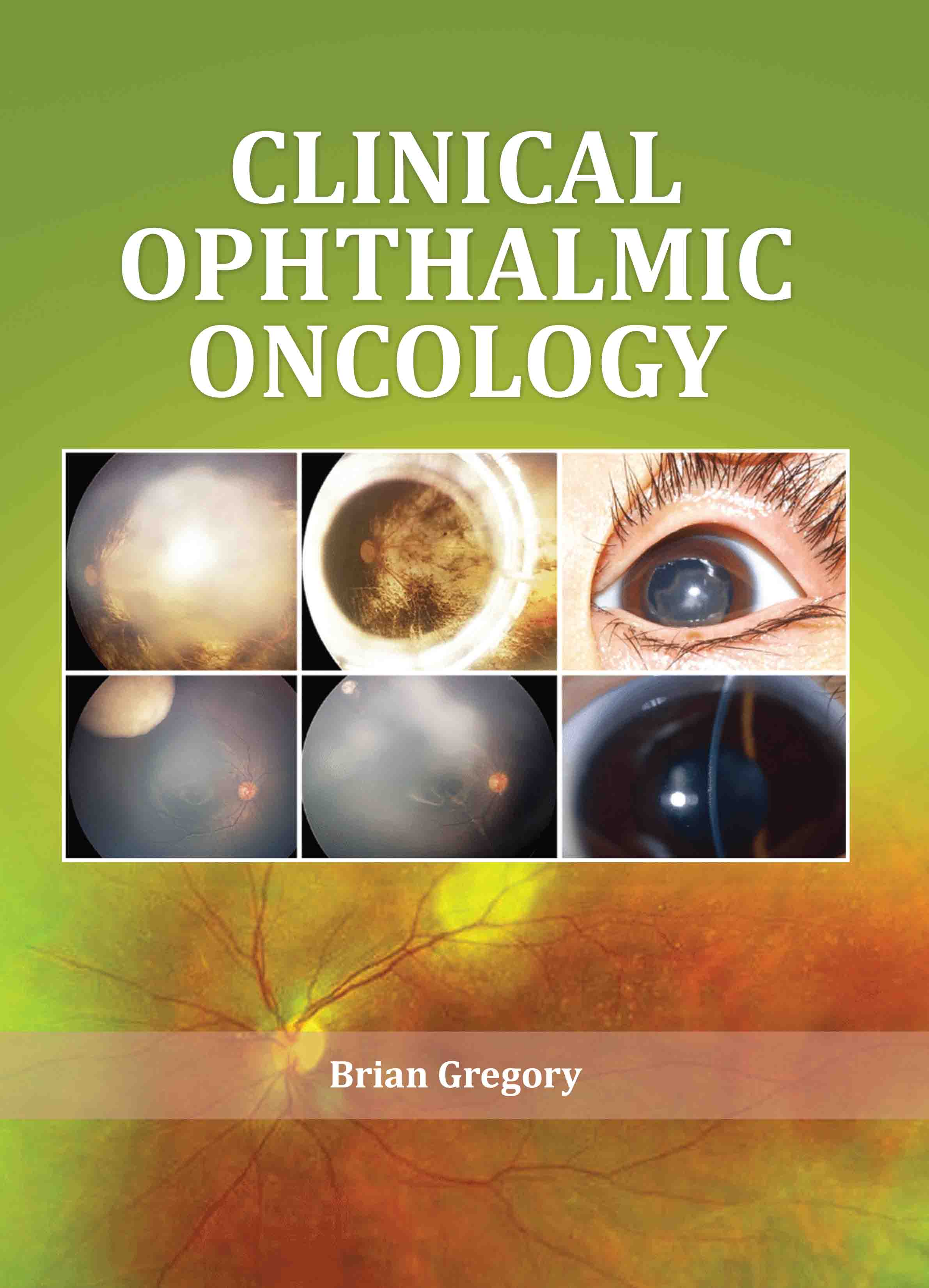 Clinical Ophthalmic Oncology