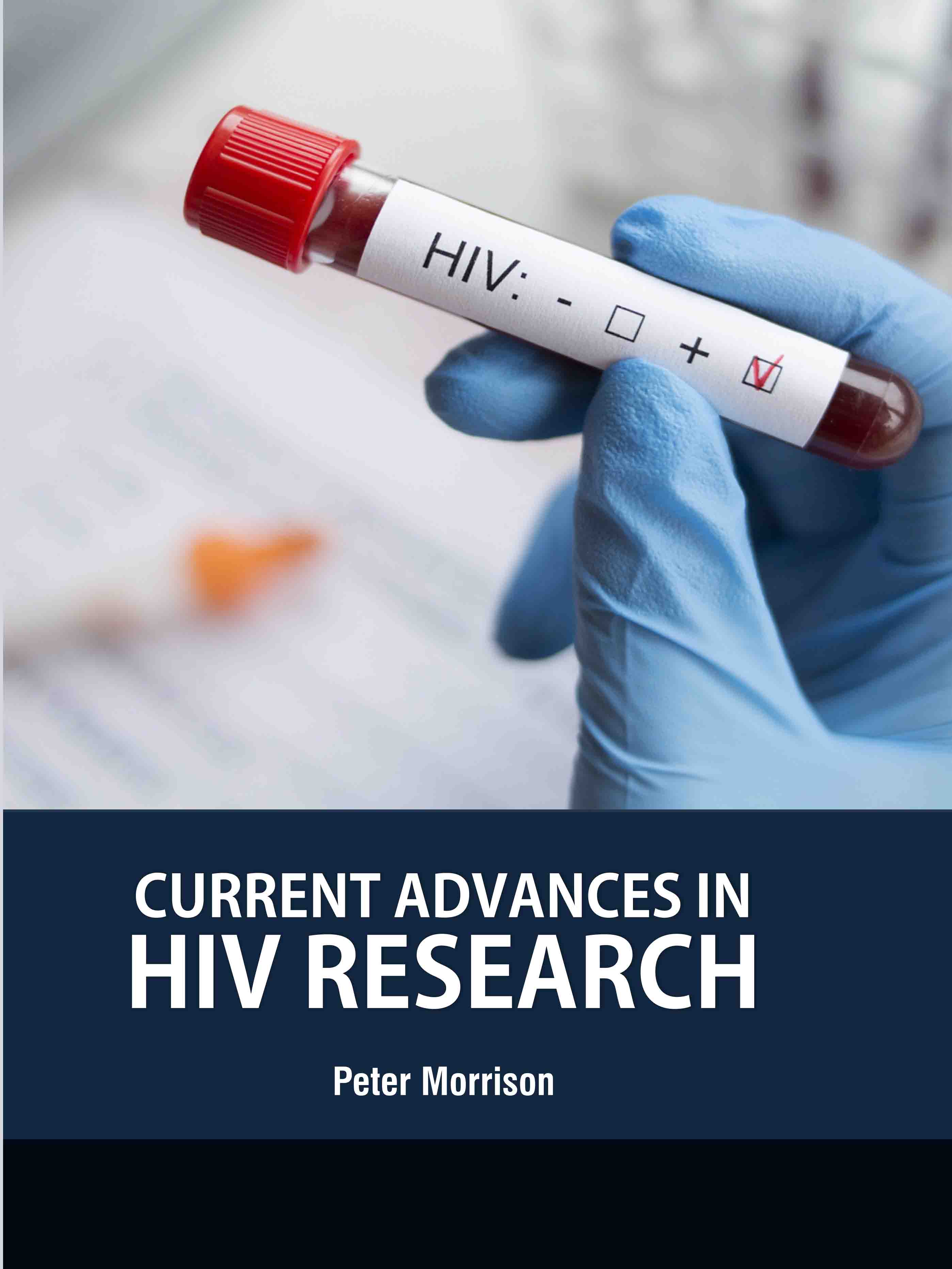 Current Advances in Hiv Research