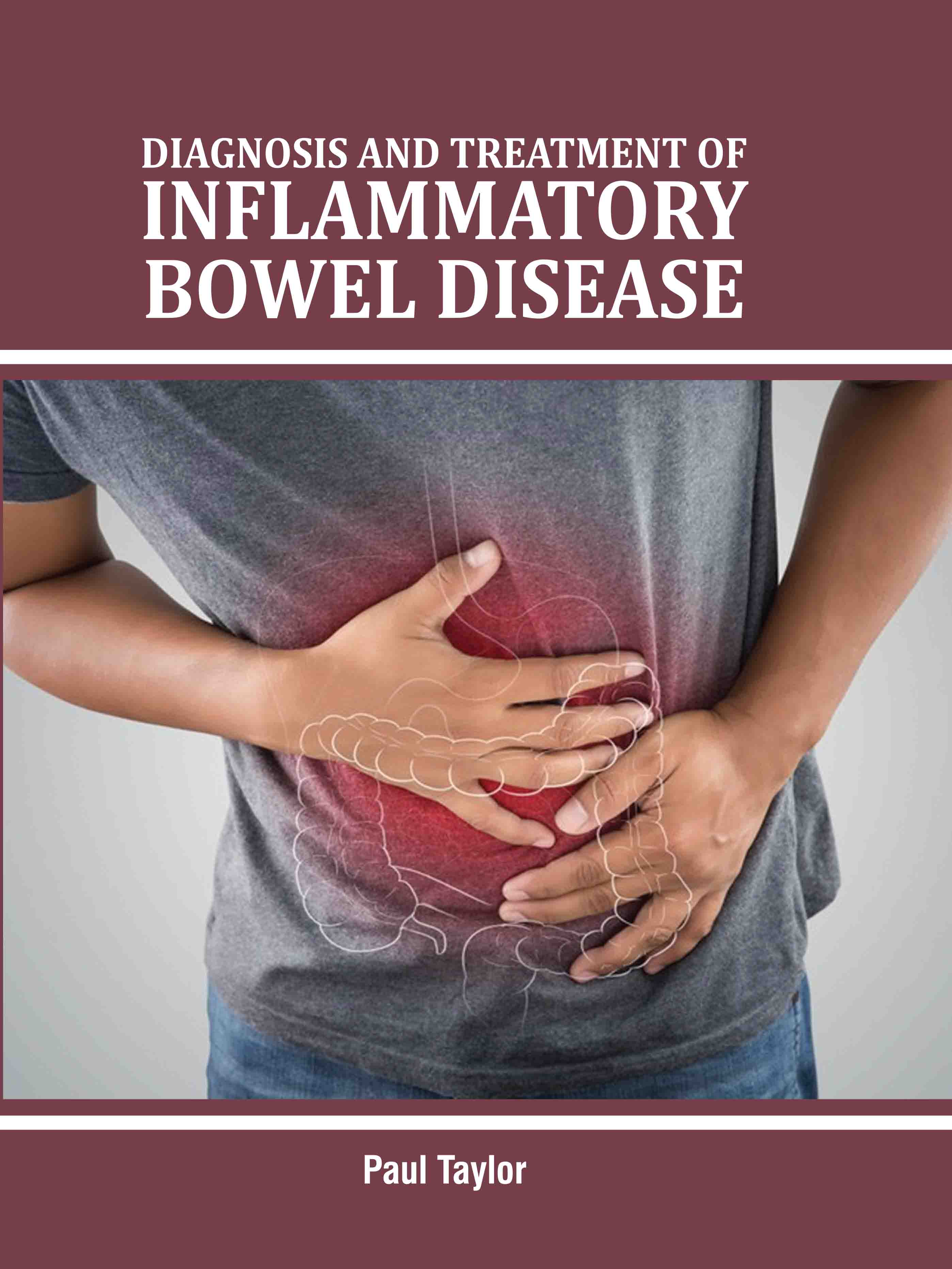 Diagnosis and Treatment of Inflammatory Bowel Disease