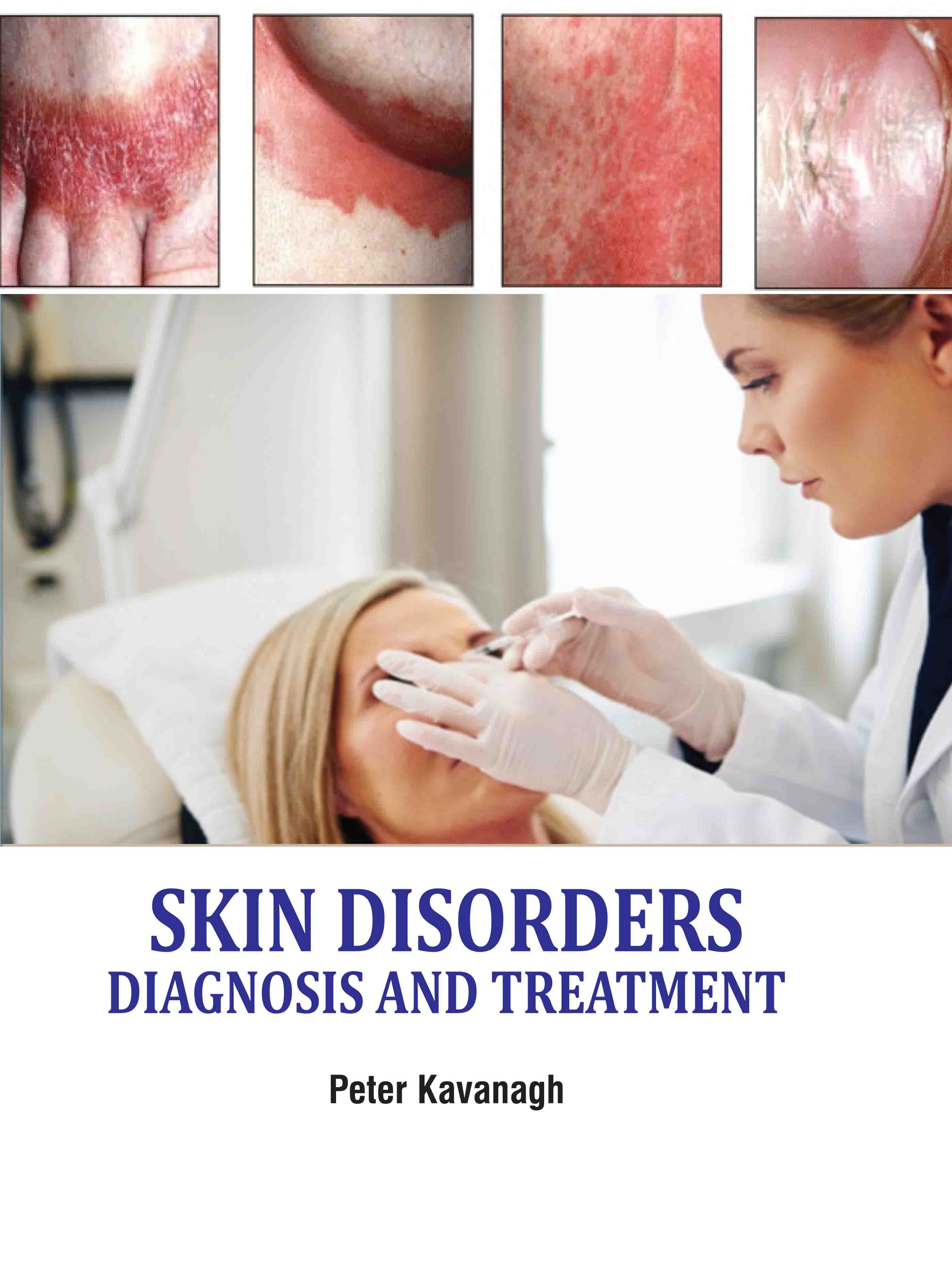 Skin Disorders: Diagnosis and Treatment