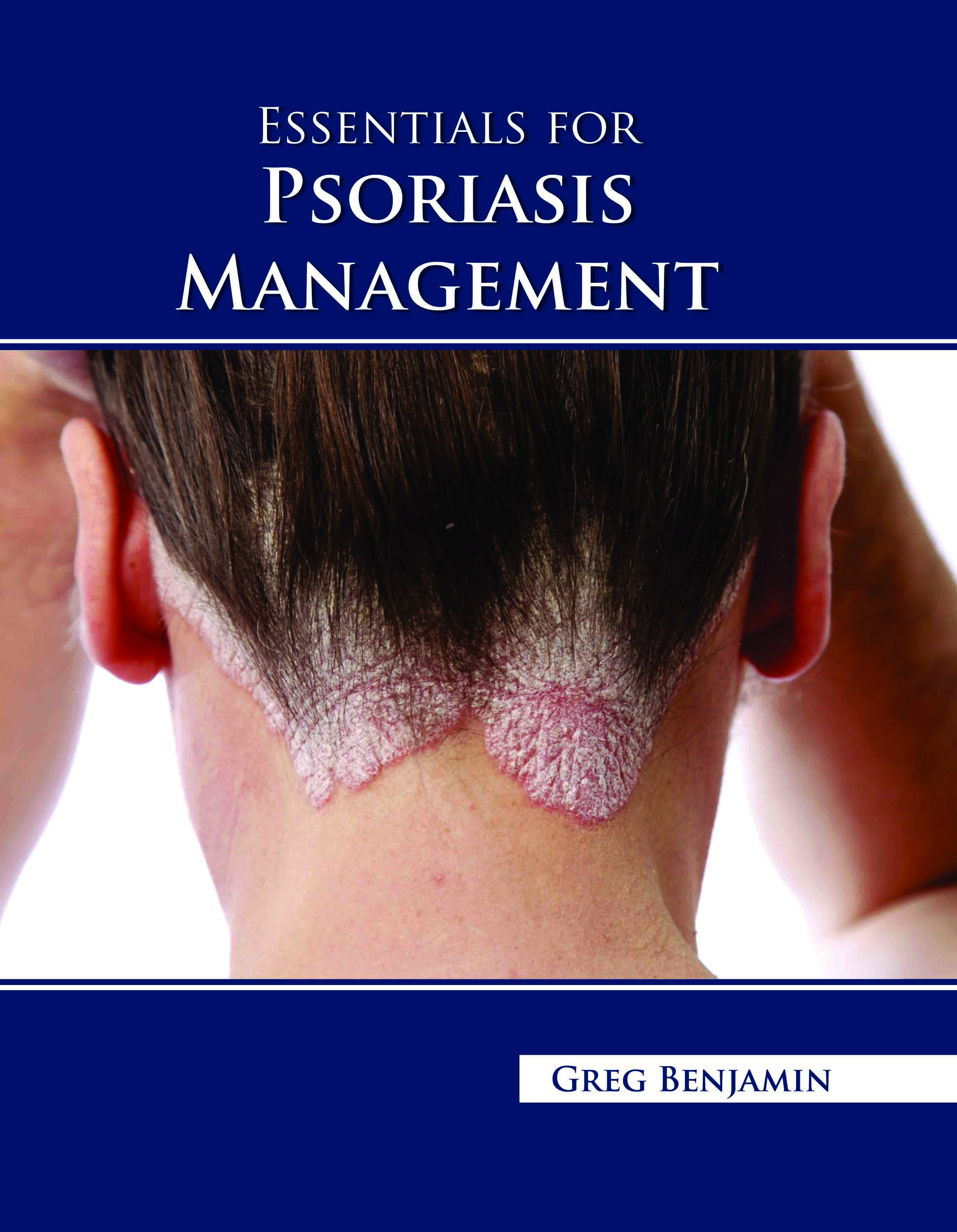 Essentials for Psoriasis Management