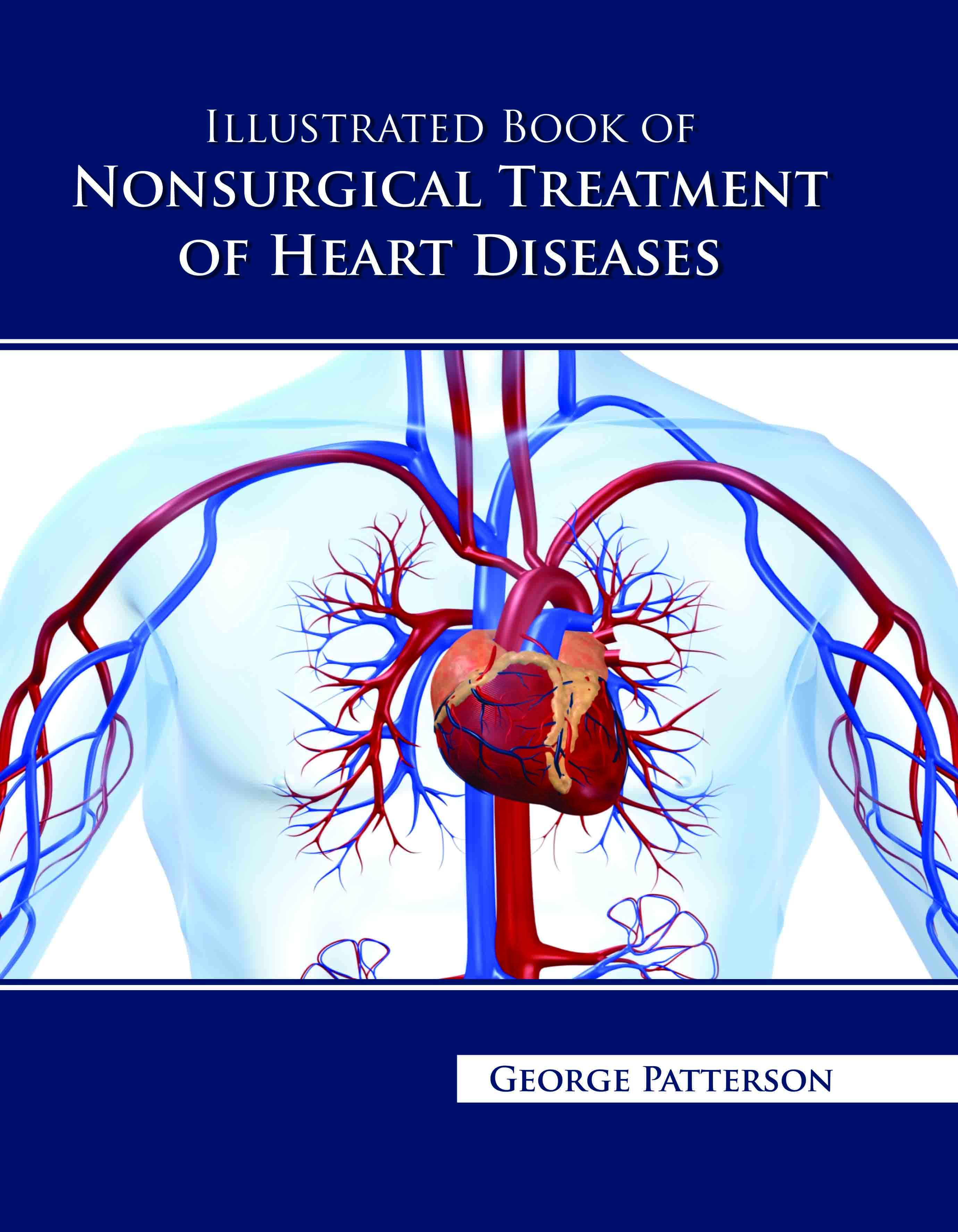 Illustrated Book of Nonsurgical Treatment of Heart Diseases