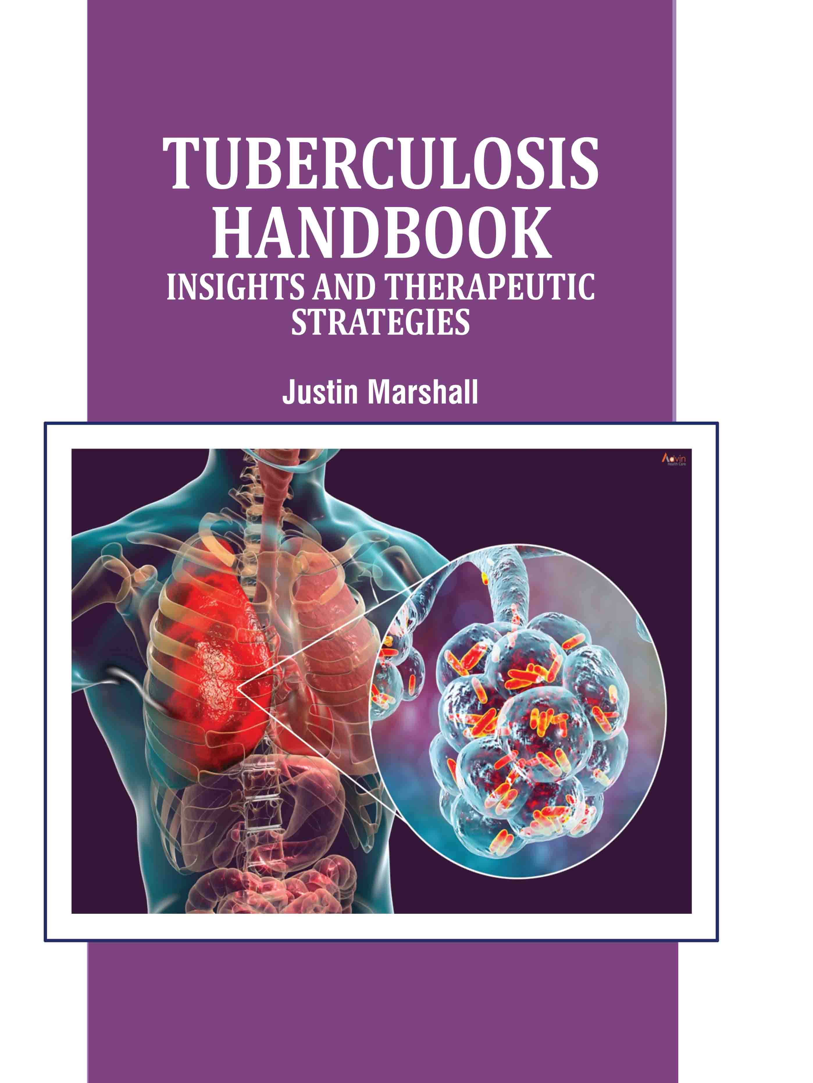 Tuberculosis Handbook: Insights and Therapeutic Strategies