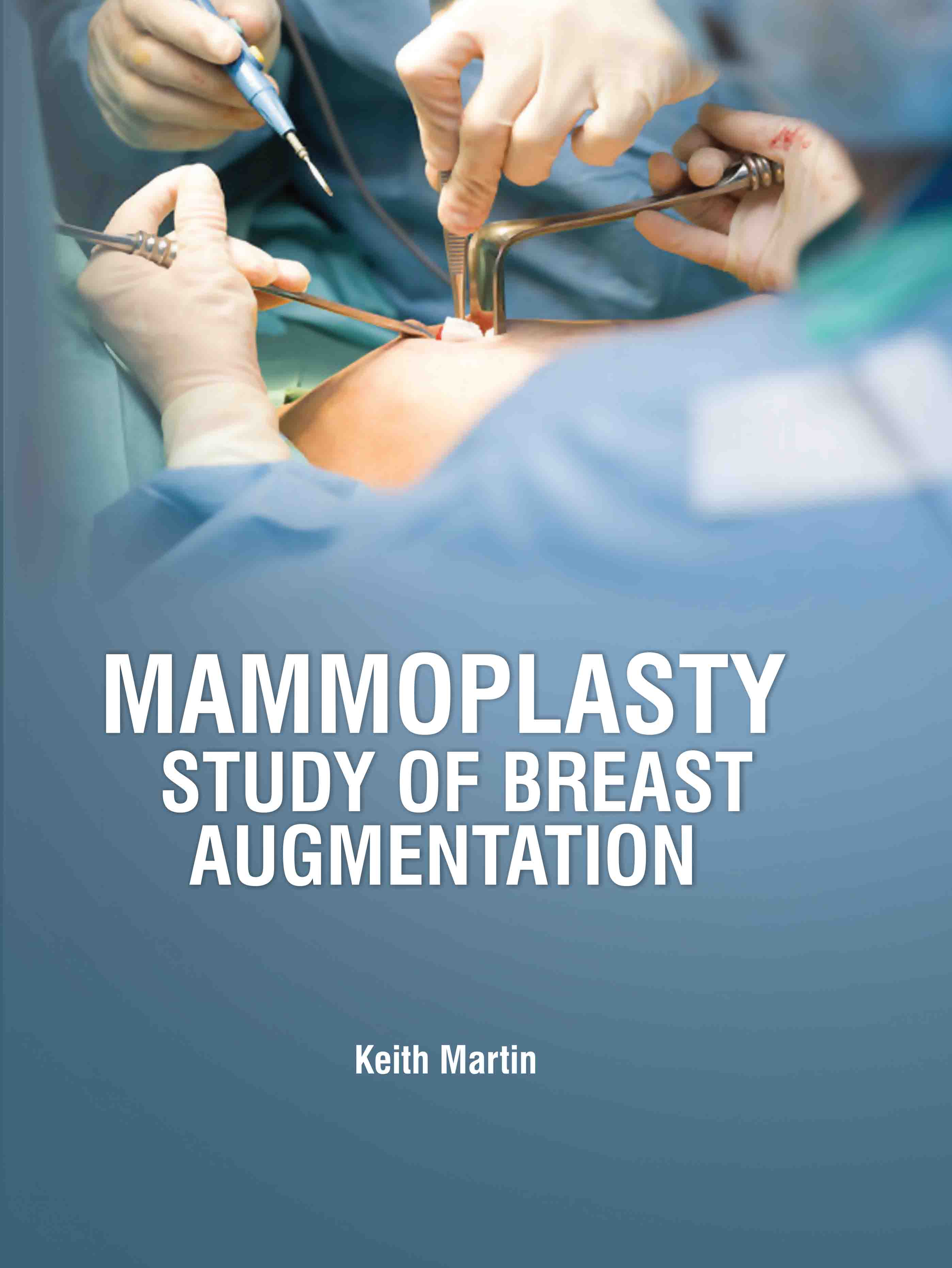Mammoplasty: Study of Breast Augmentation
