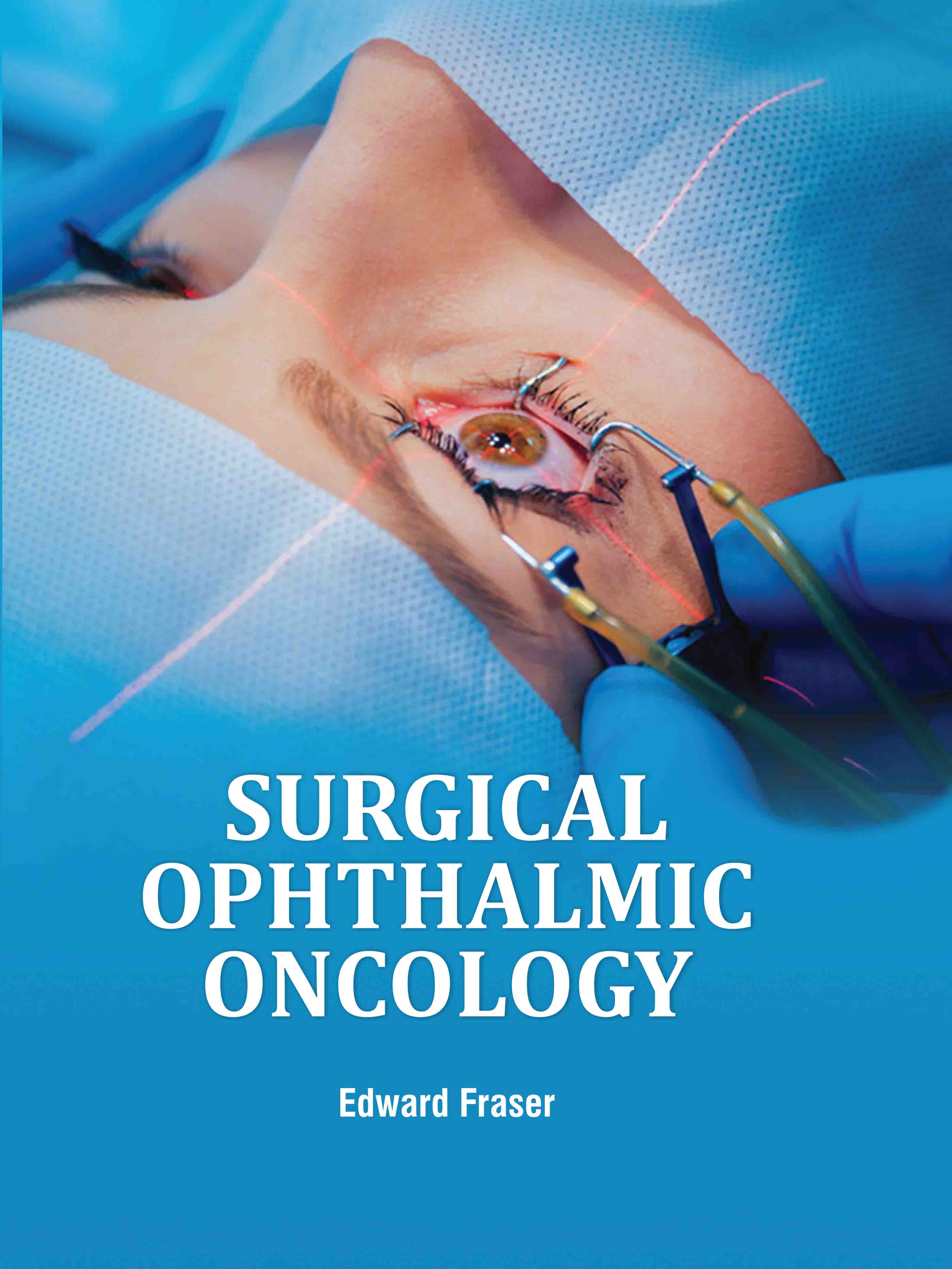 Surgical Ophthalmic Oncology