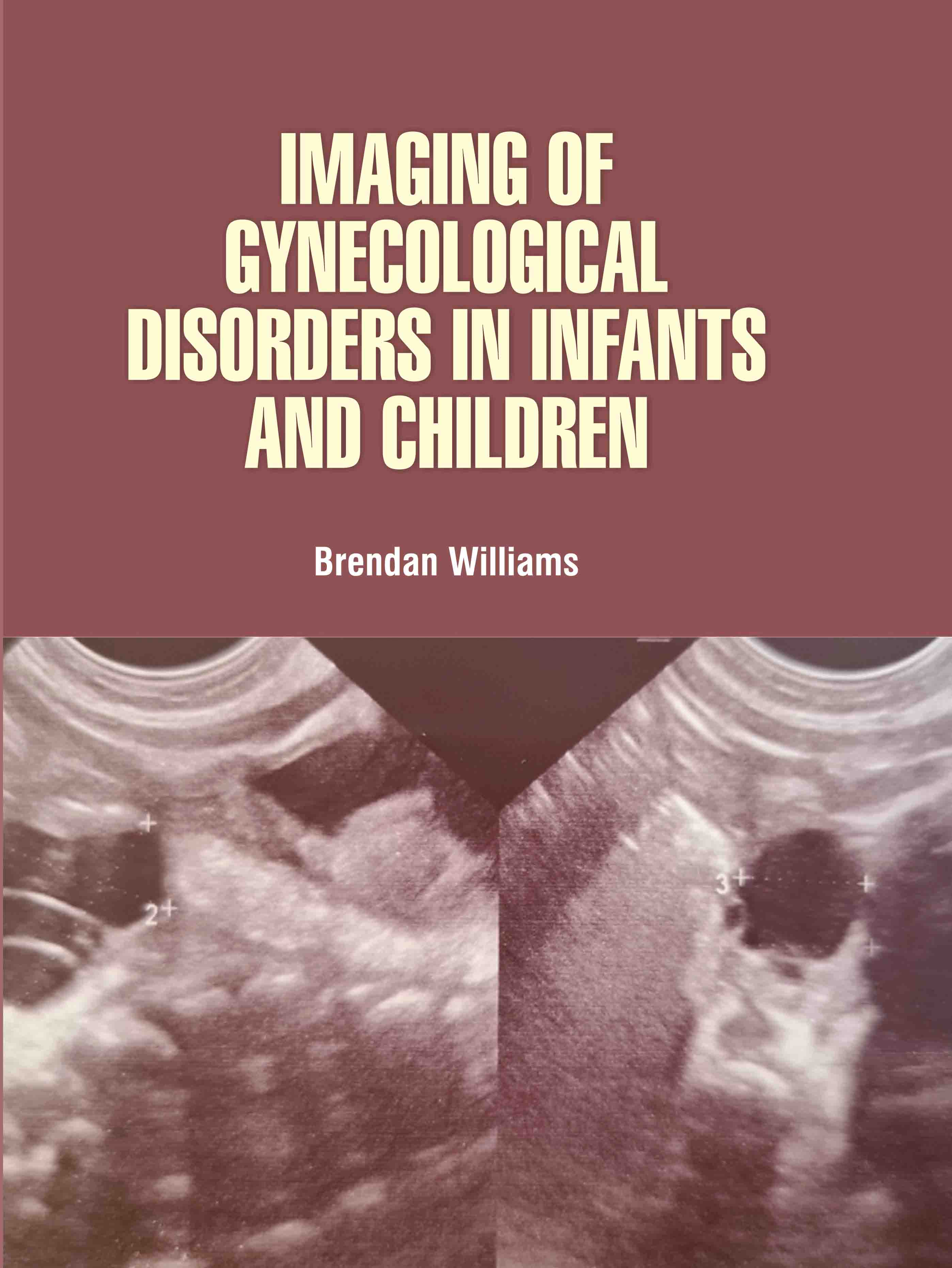 Imaging of Gynecological Disorders in Infants and Children