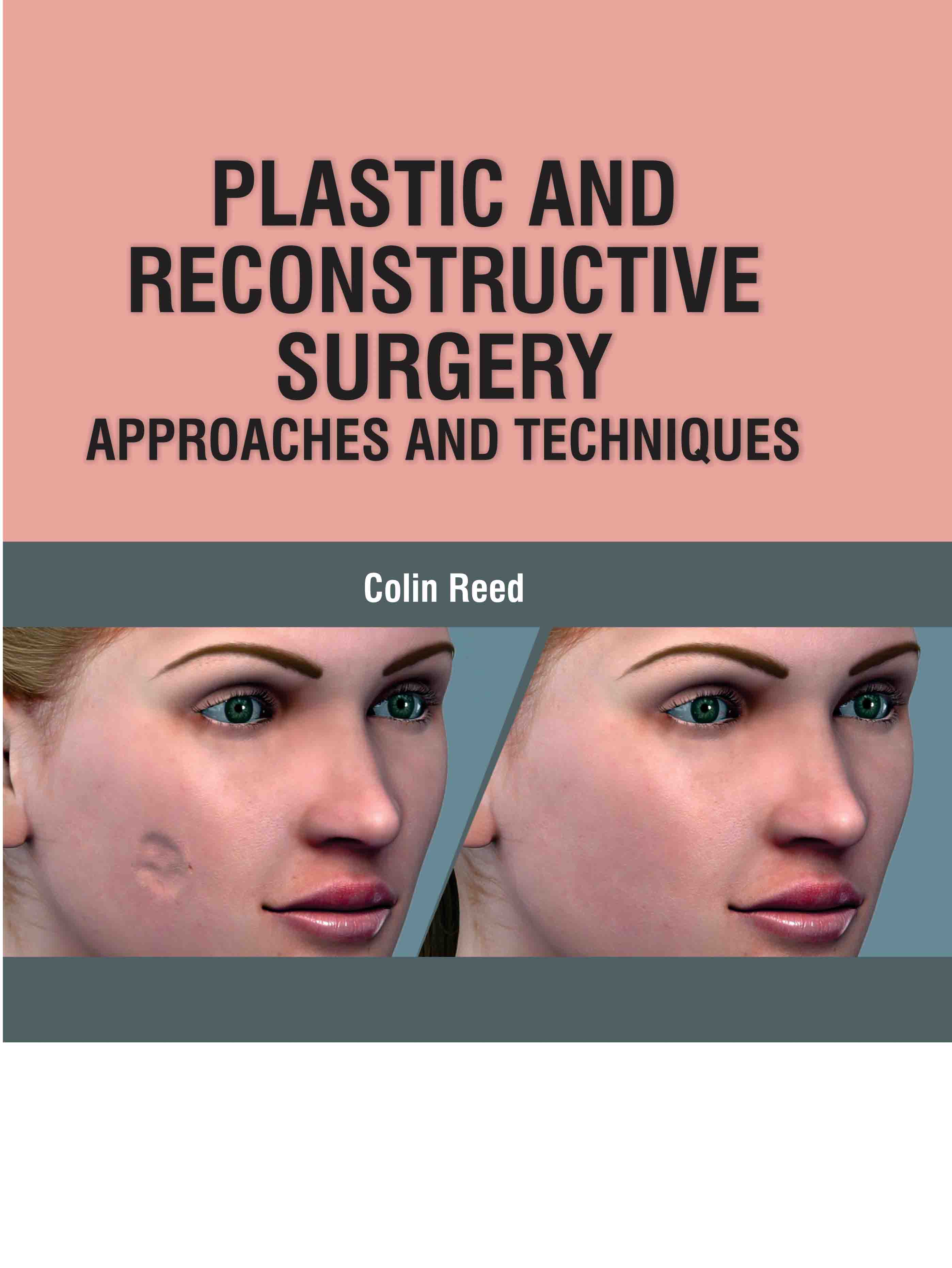 Plastic and Reconstructive Surgery: Approaches and Techniques