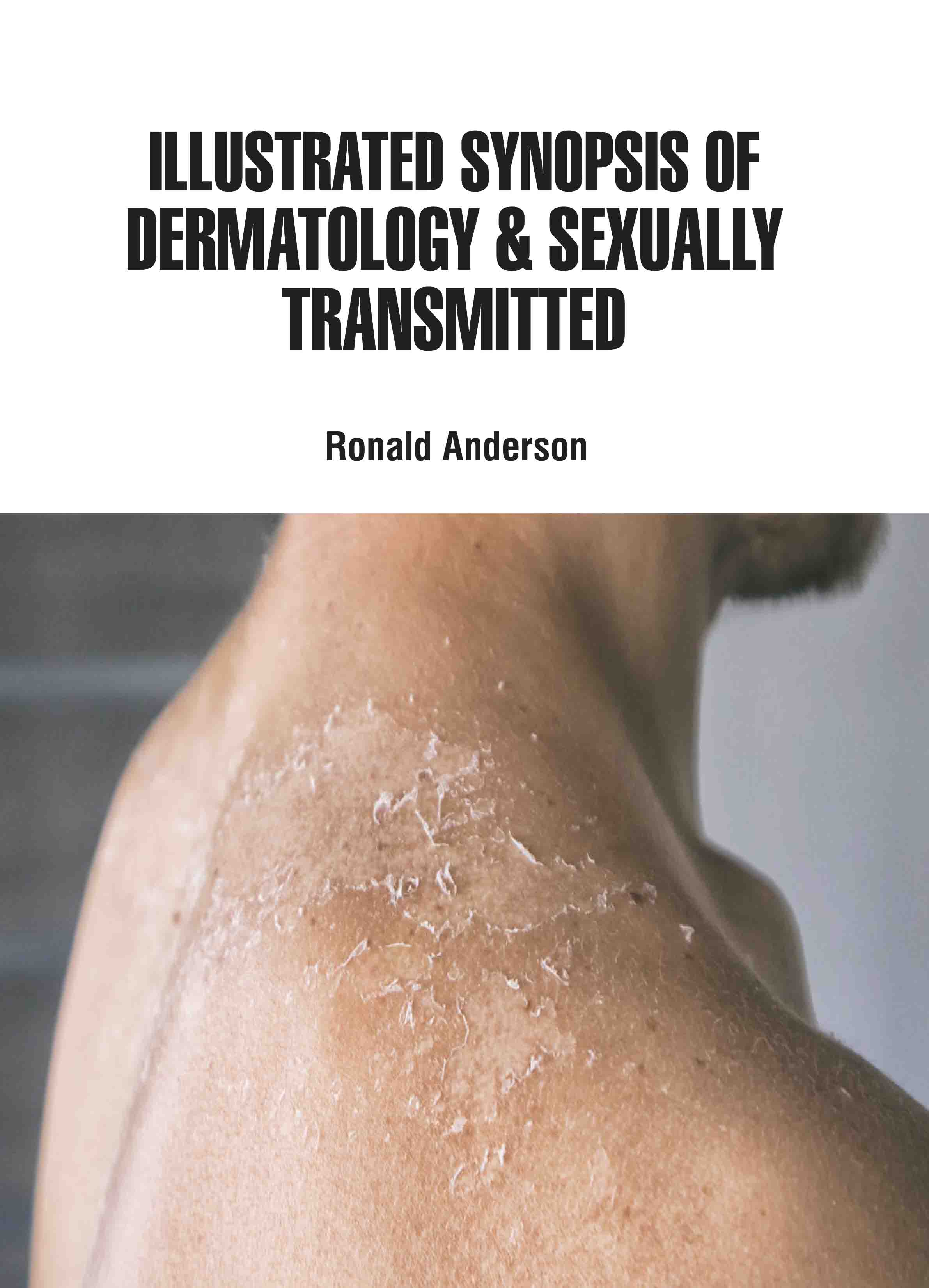 Illustrated Synopsis of Dermatology & Sexually Transmitted