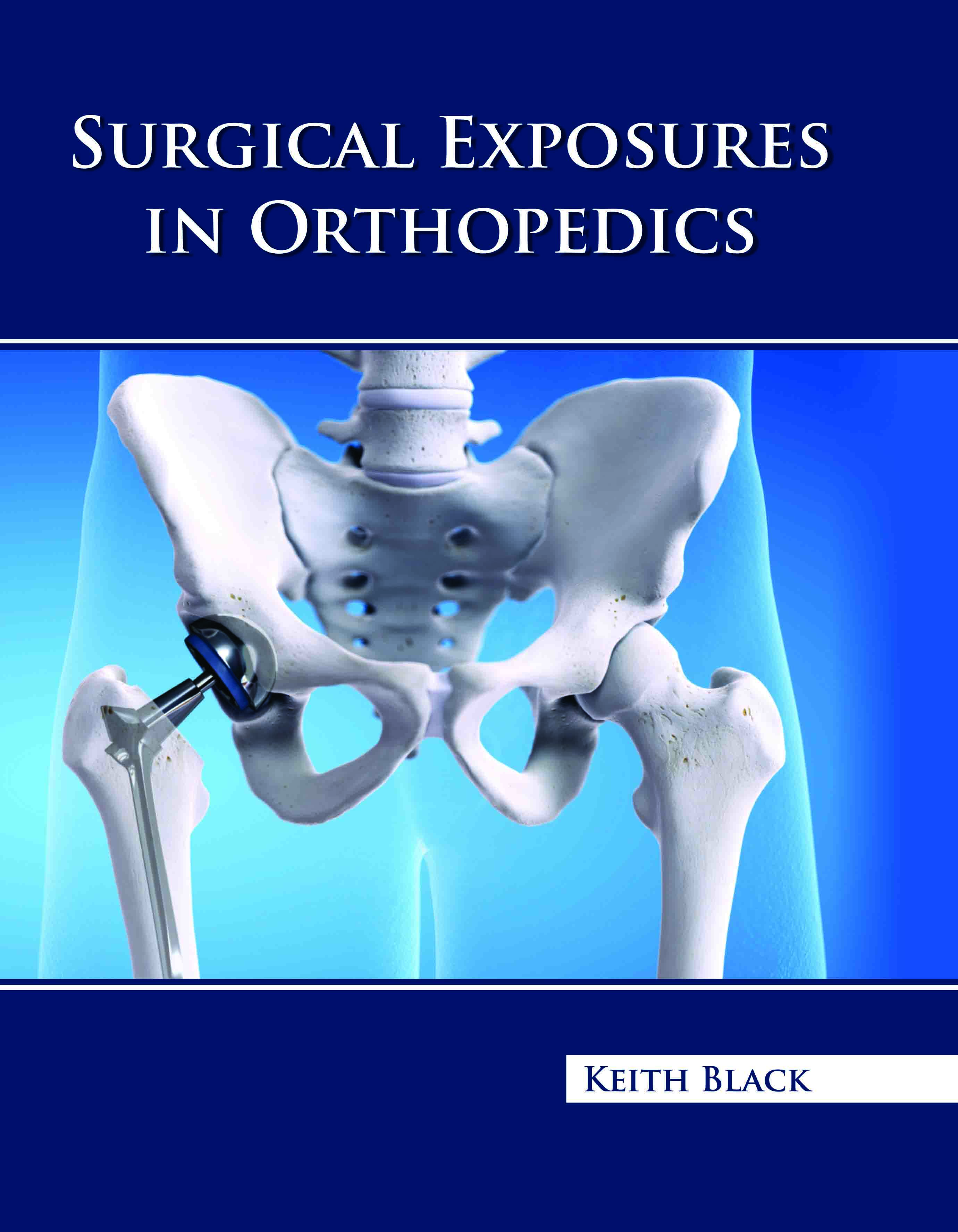 Surgical Exposures in Orthopedics