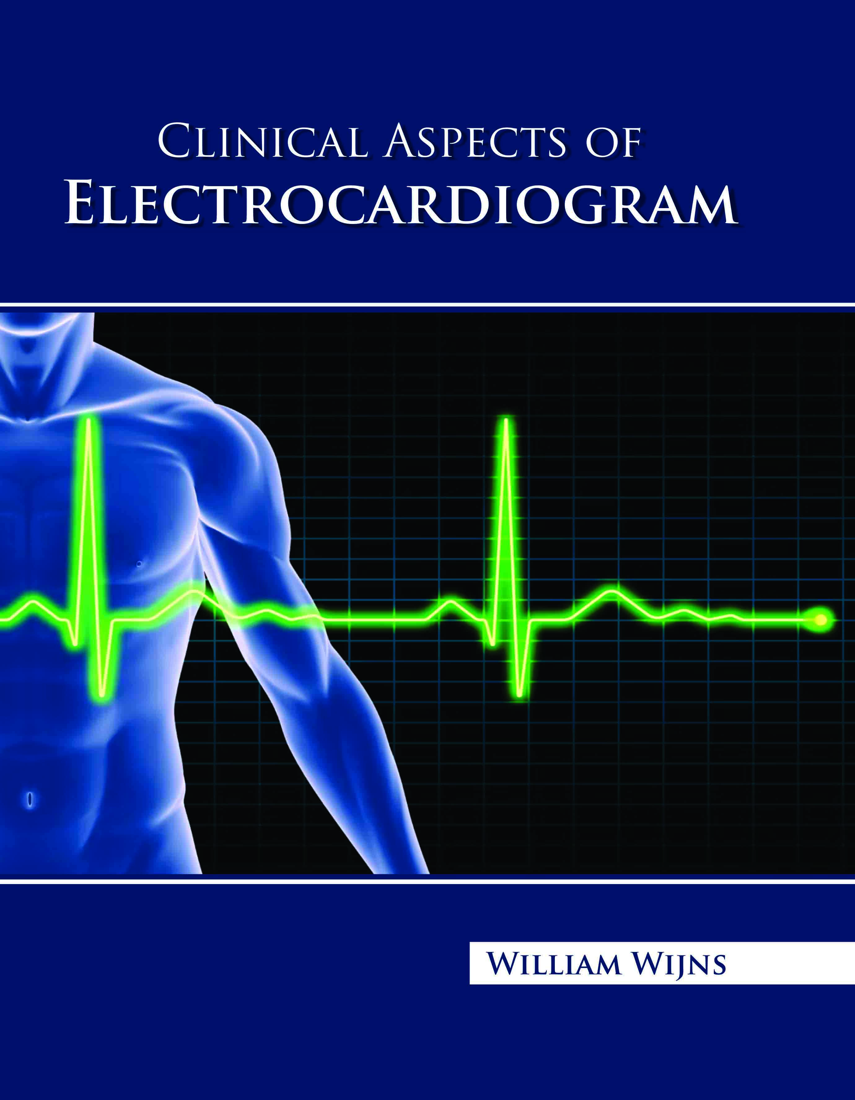 Clinical Aspects of Electrocardiogram