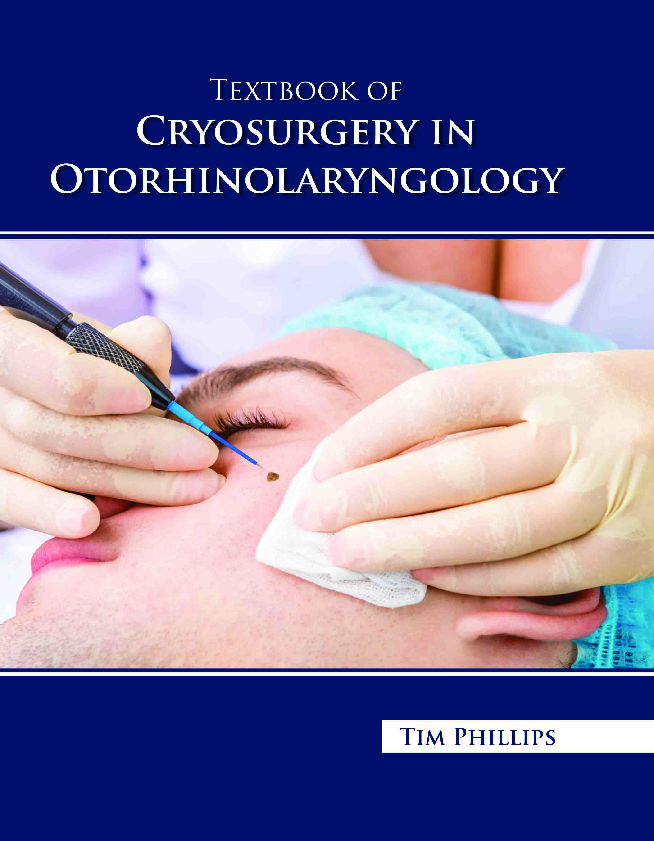 Textbook of Cryosurgery in Otorhinolaryngology