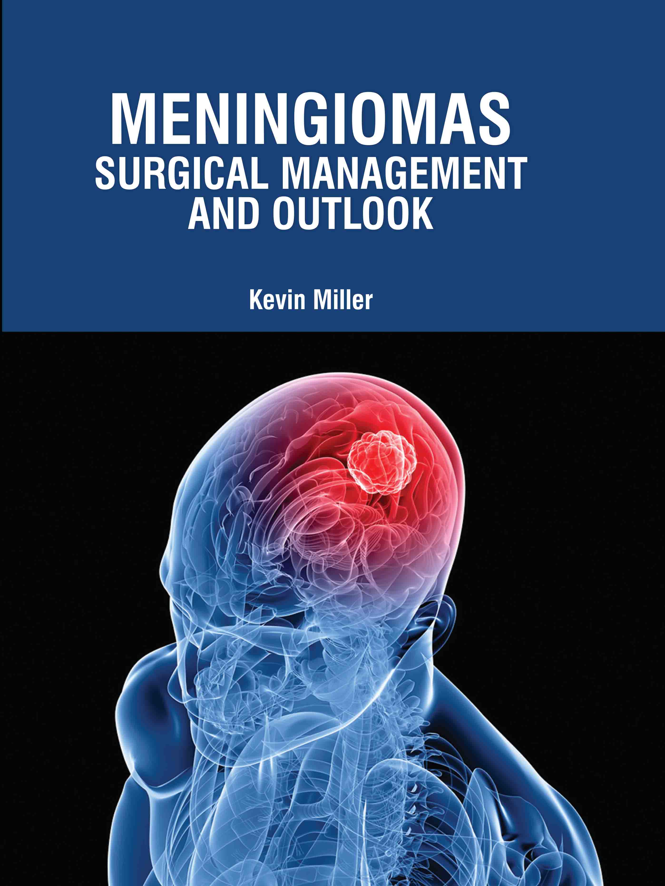 Meningiomas: Surgical Management and Outlook