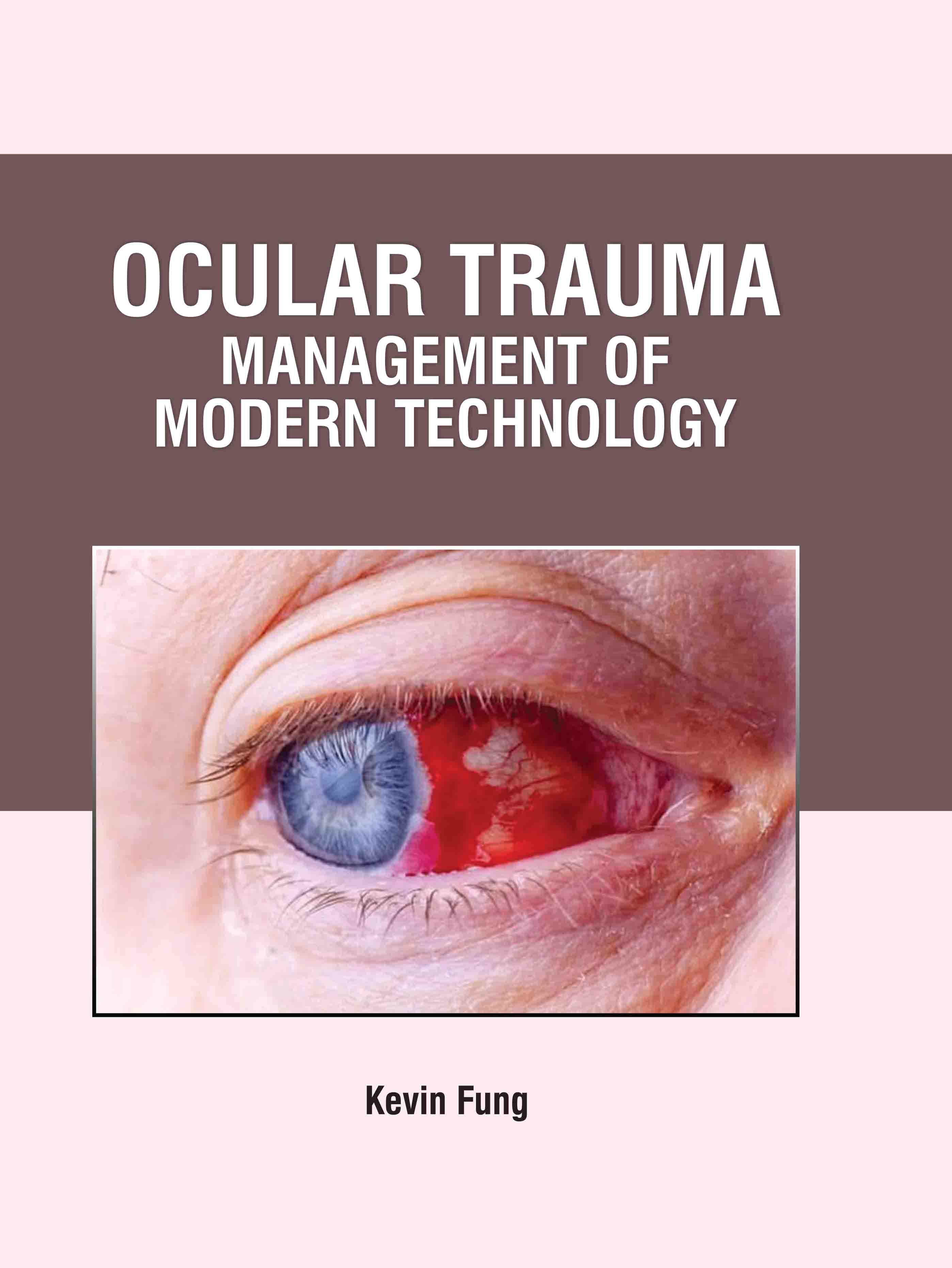 Ocular Trauma: Management of Modern Technology