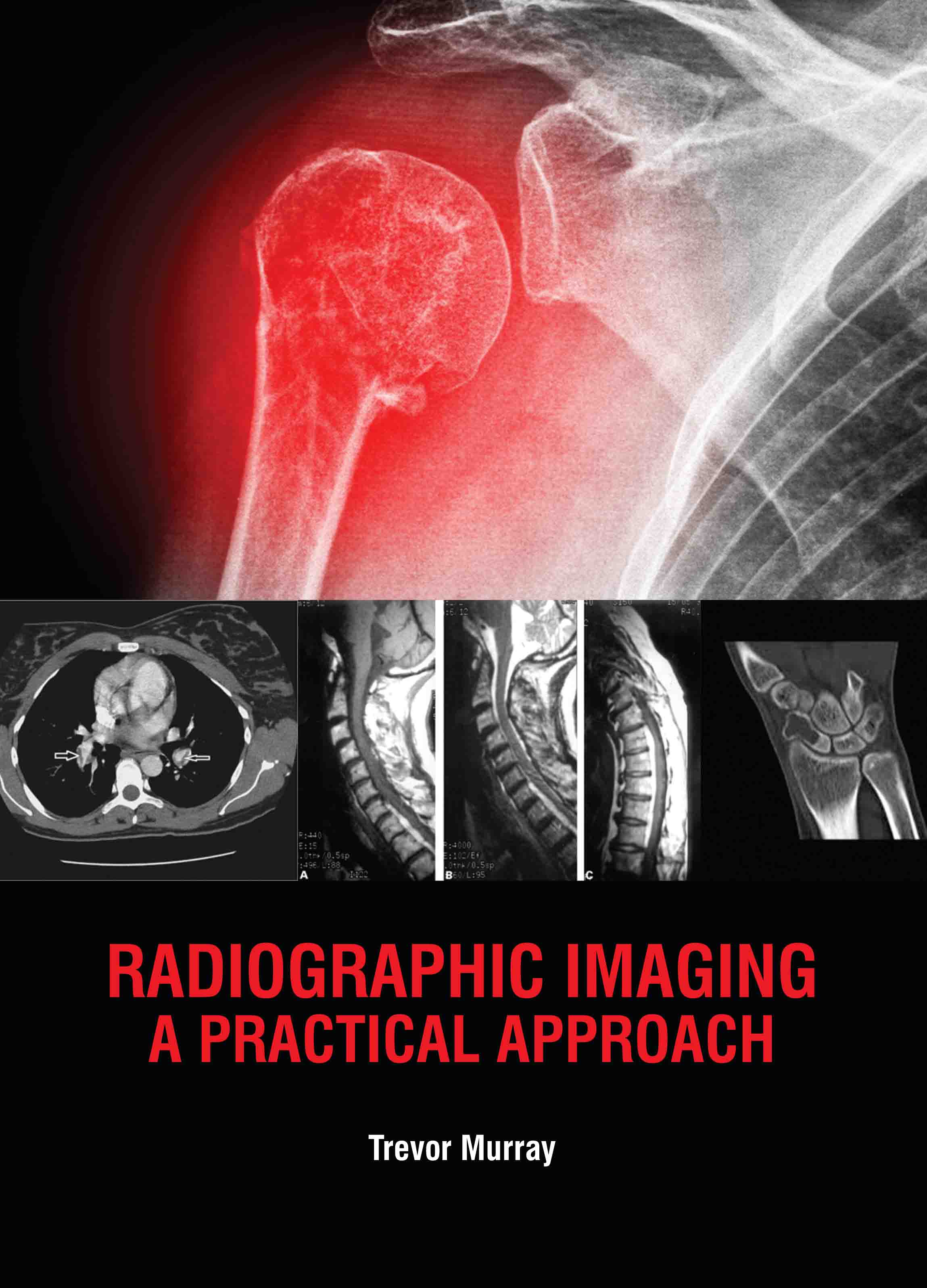 Radiographic Imaging: A Practical Approach