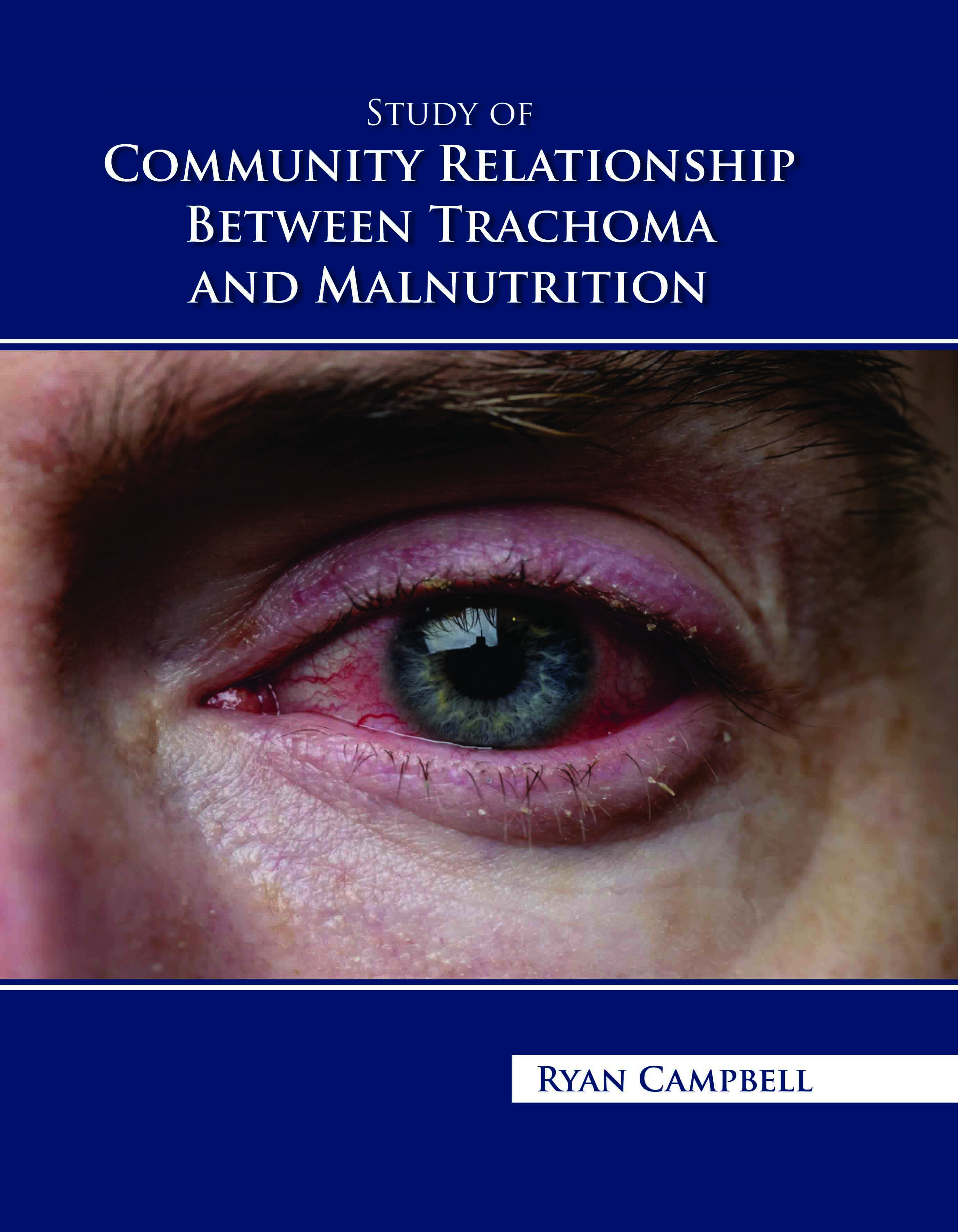 Study of Community Relationship Between Trachoma and Malnutrition 