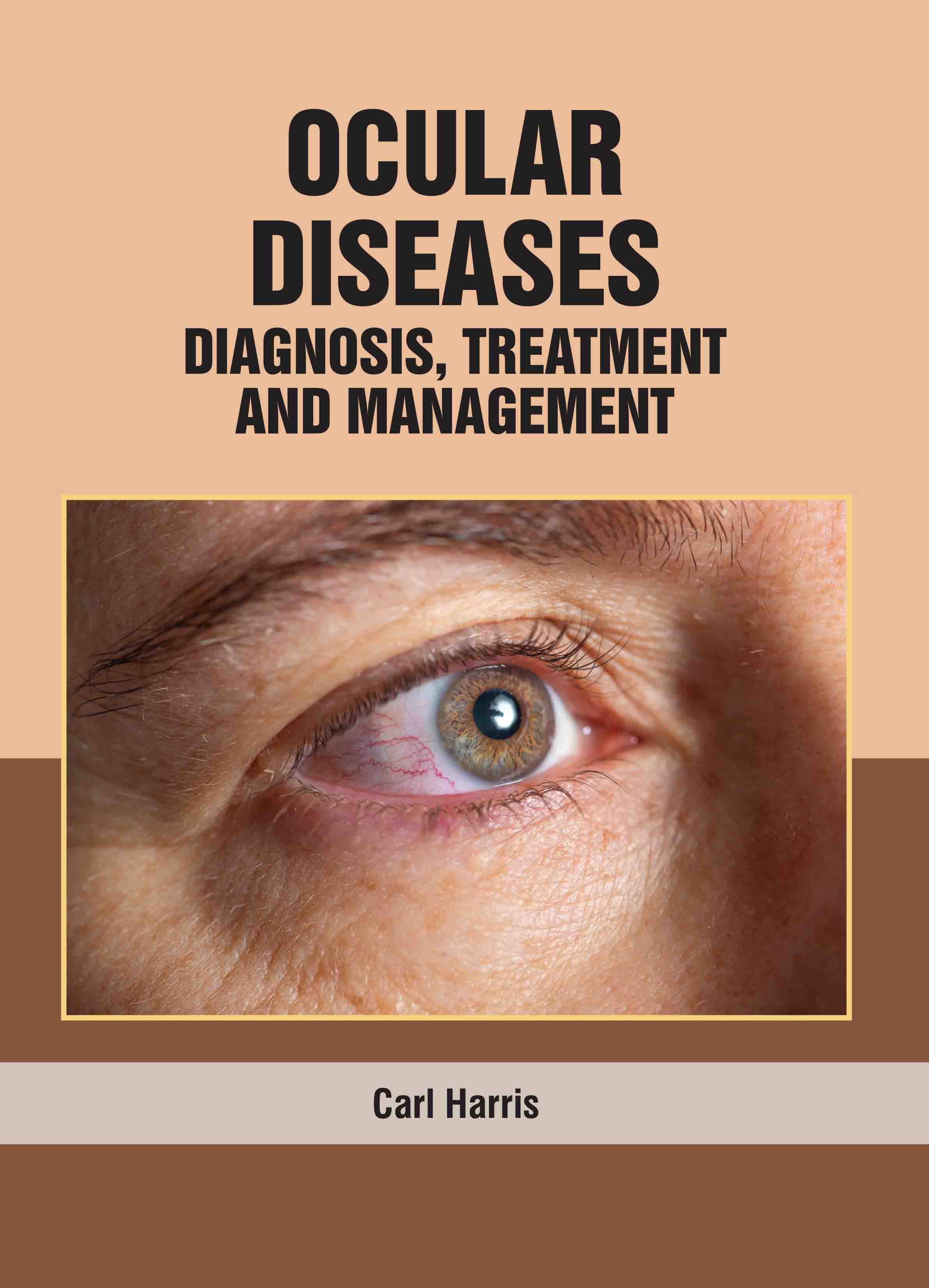 Ocular Diseases: Diagnosis, Treatment, and Management