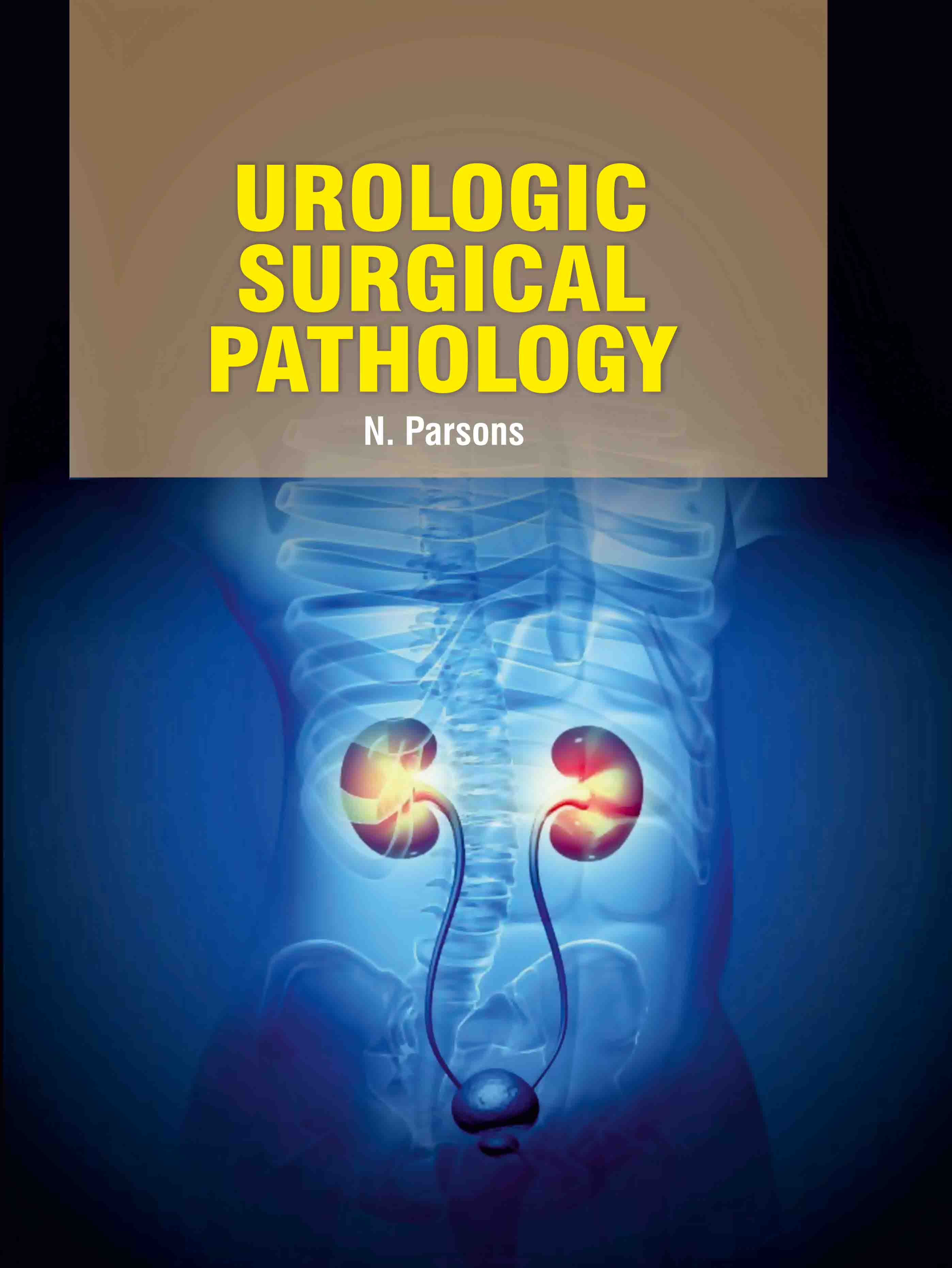 Urologic Surgical Pathology