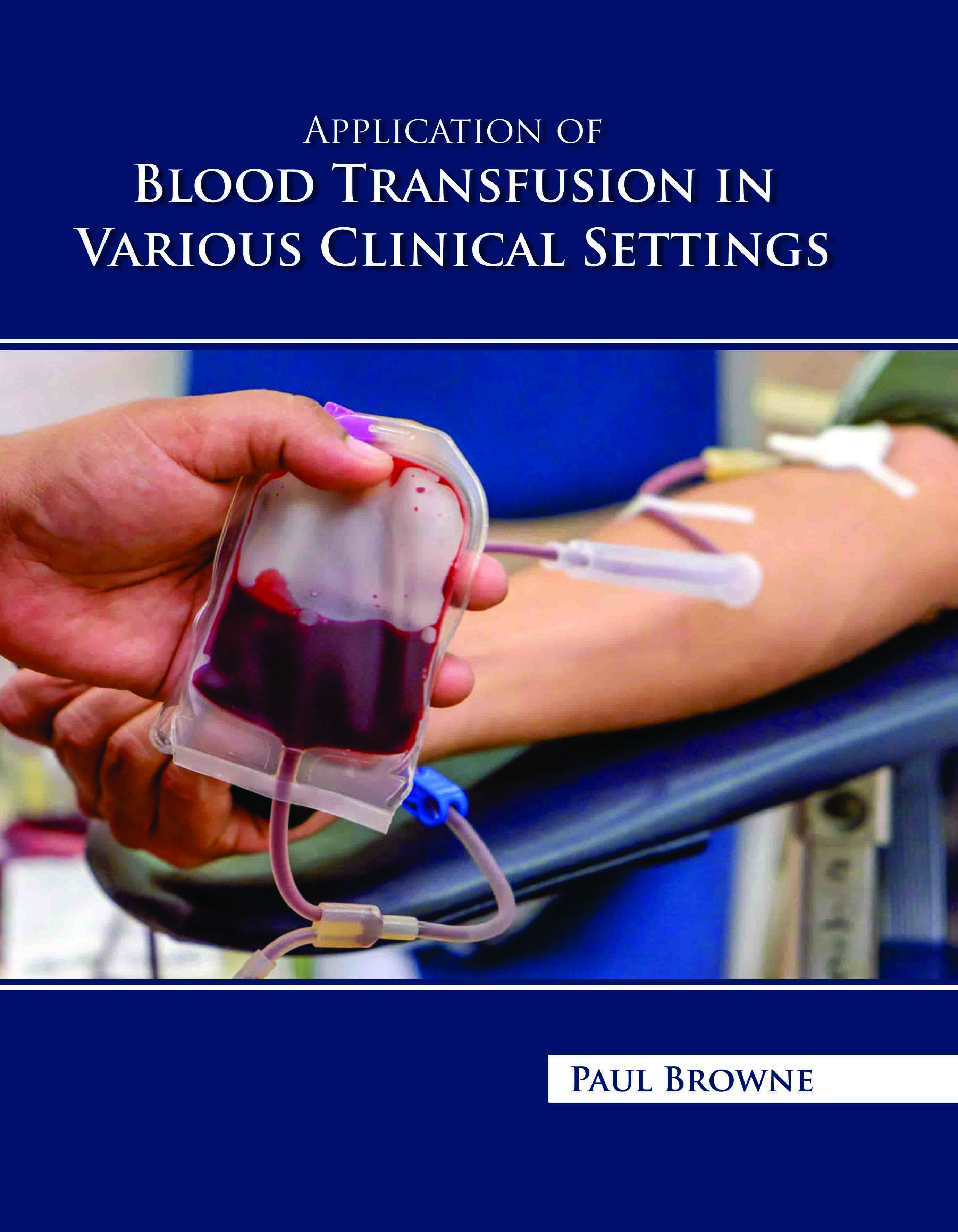 Application of Blood Transfusion in Various Clinical Settings