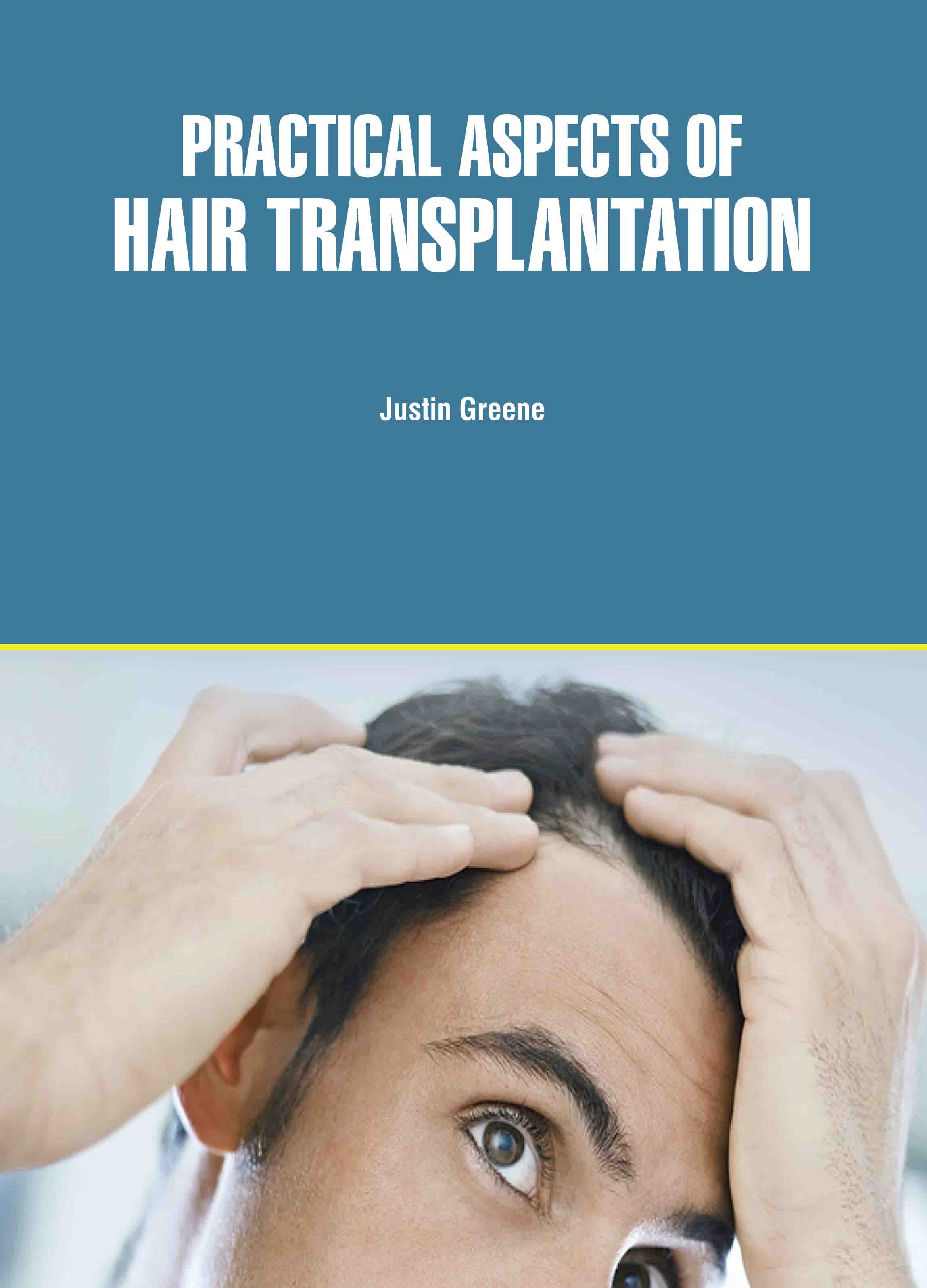 Practical Aspects of Hair Transplantation