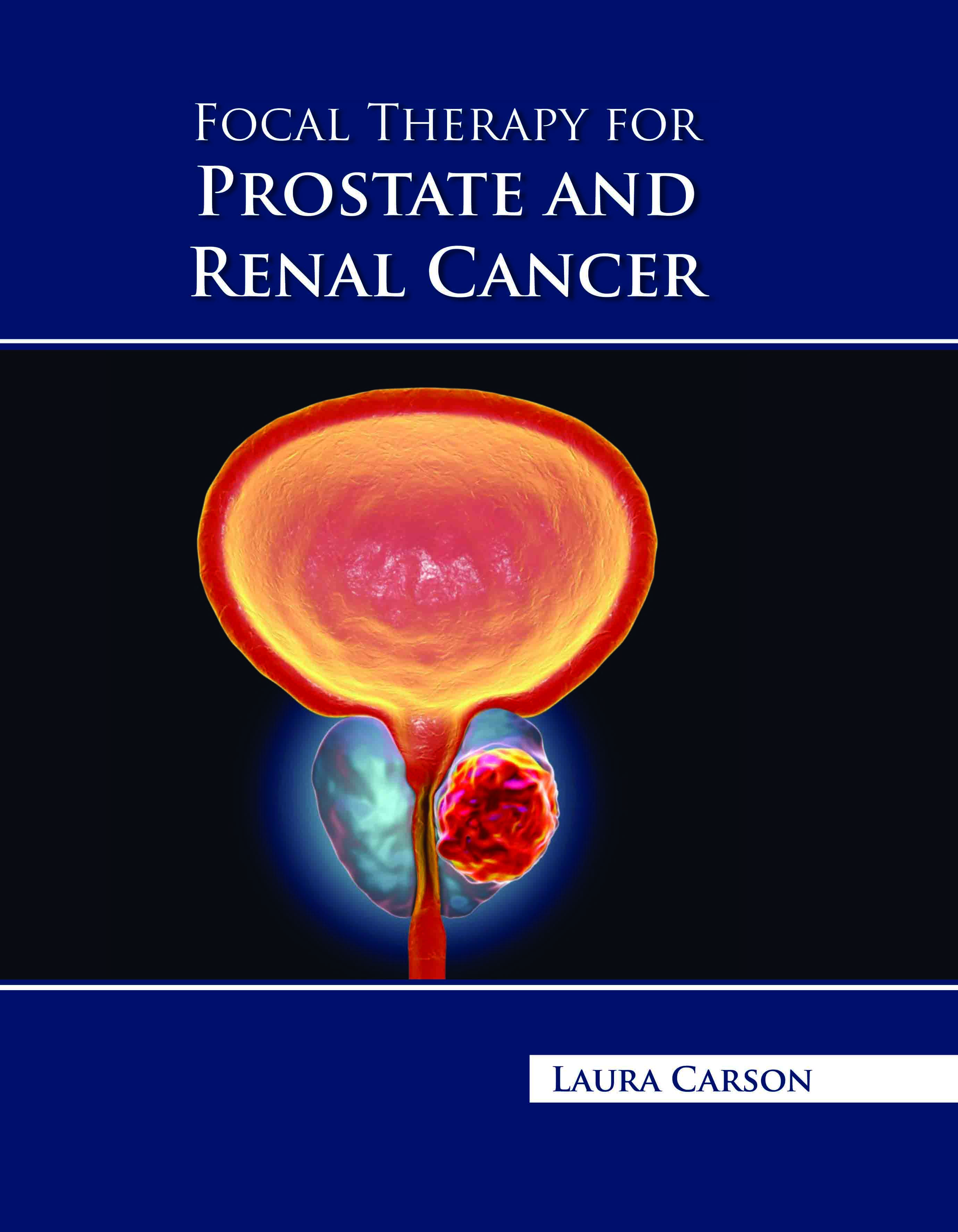 Focal Therapy for Prostate and Renal Cancer