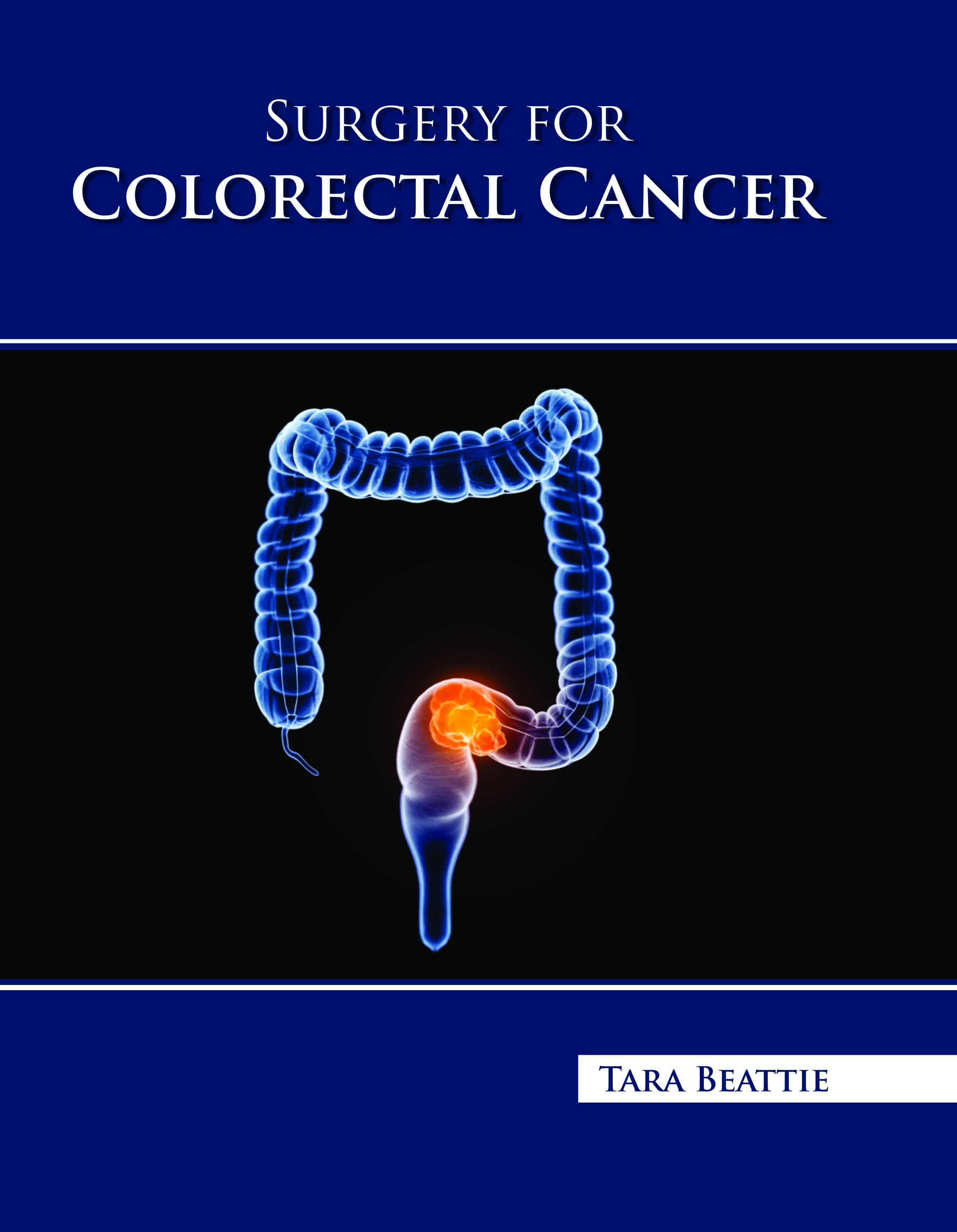 Surgery for Colorectal Cancer