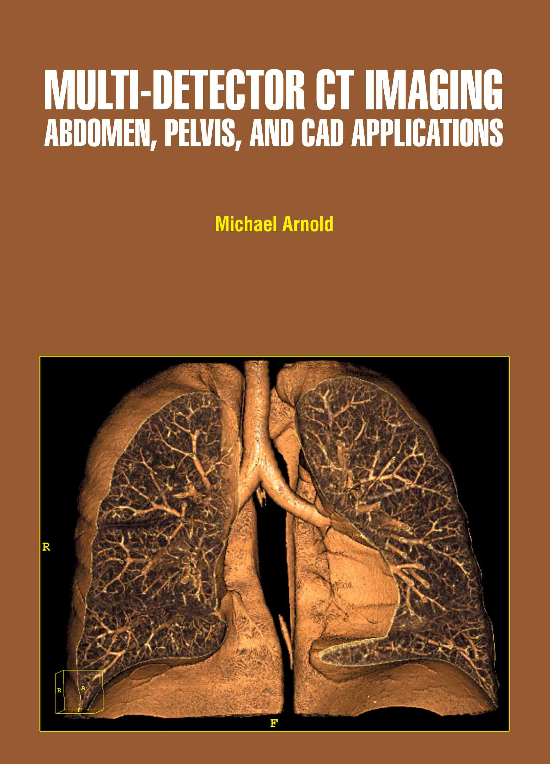 Multi-Detector Ct Imaging: Abdomen, Pelvis and Cad Applications