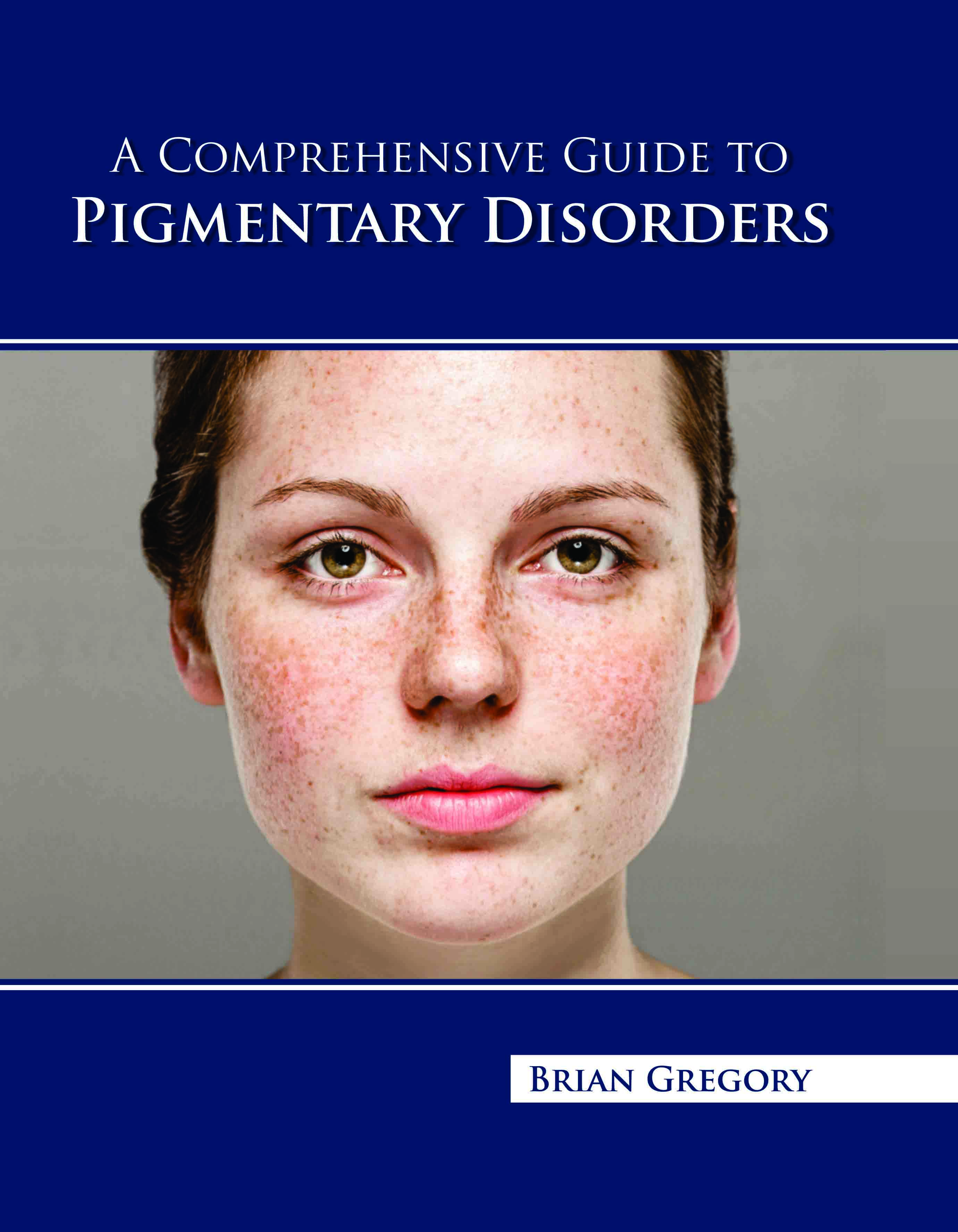 A Comprehensive Guide to Pigmentary Disorders