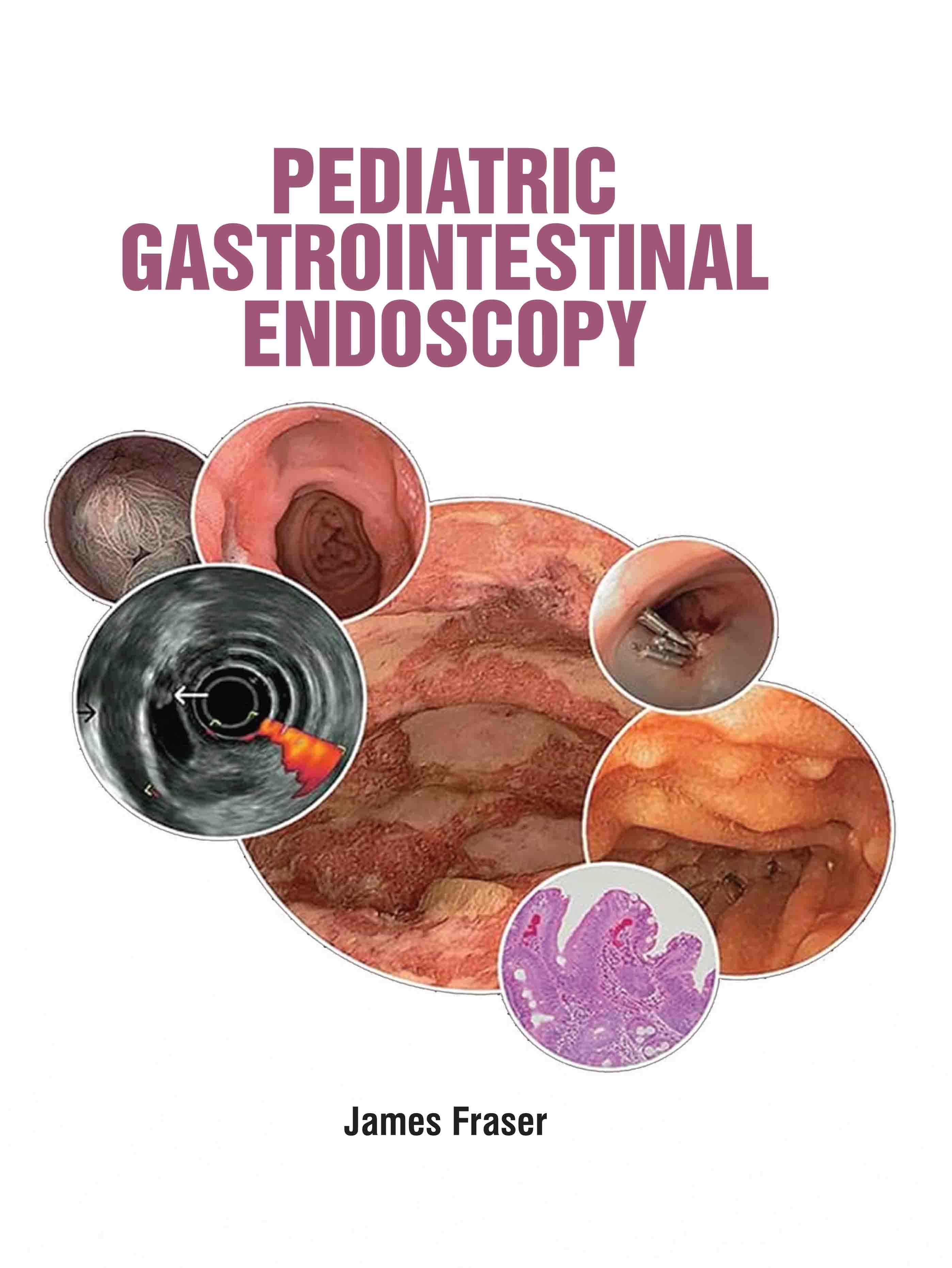 Pediatric Gastrointestinal Endoscopy