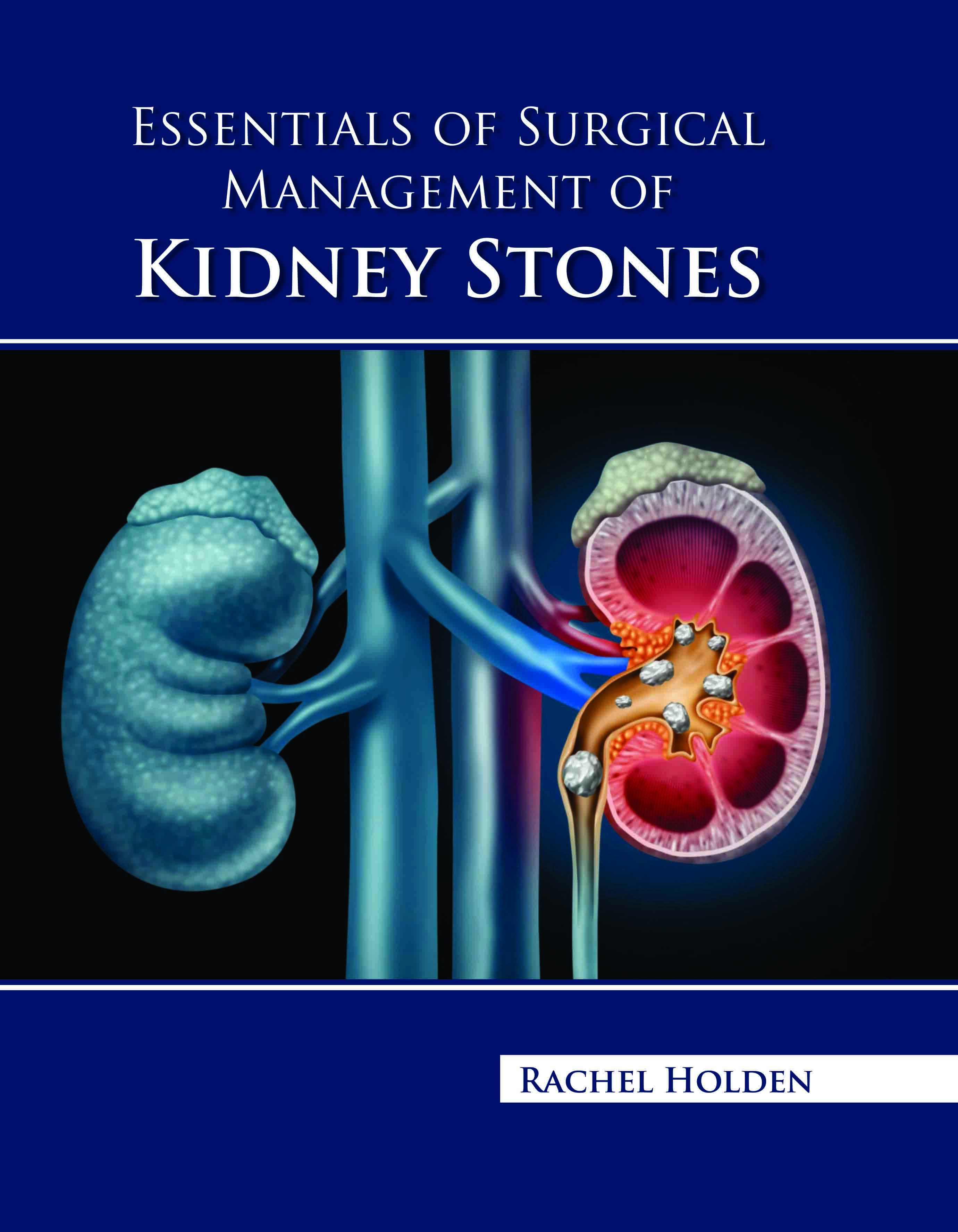 Essentials of Surgical Management of Kidney Stones 