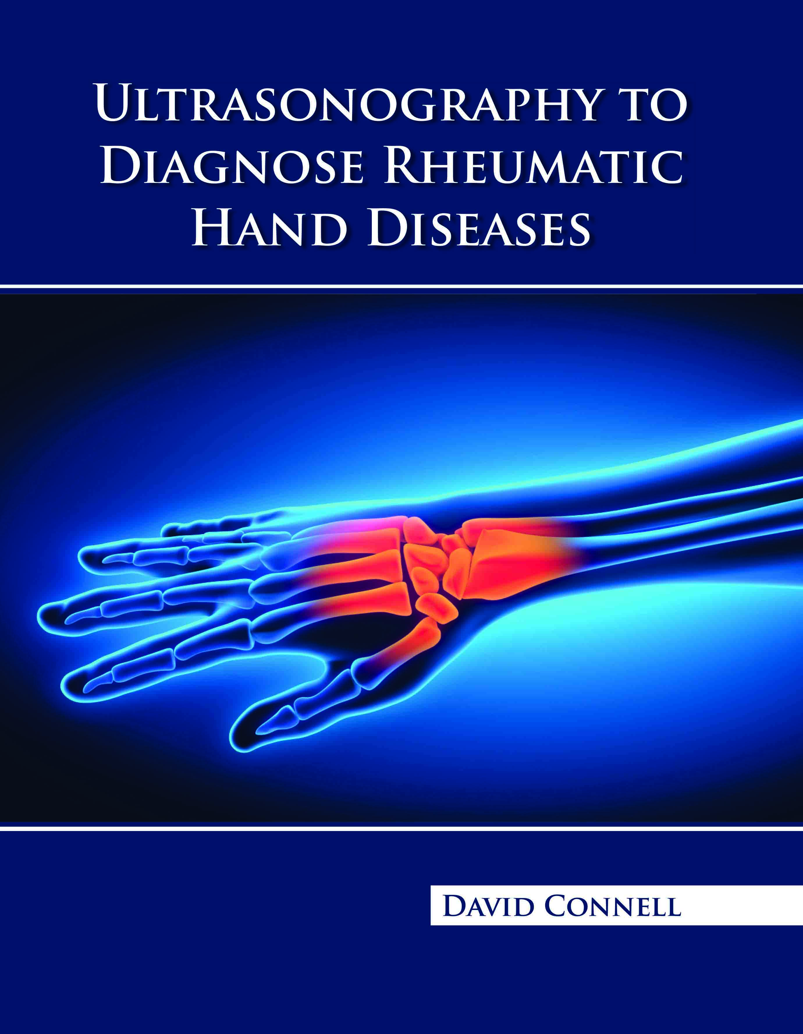 Ultrasonography to Diagnose Rheumatic Hand Diseases